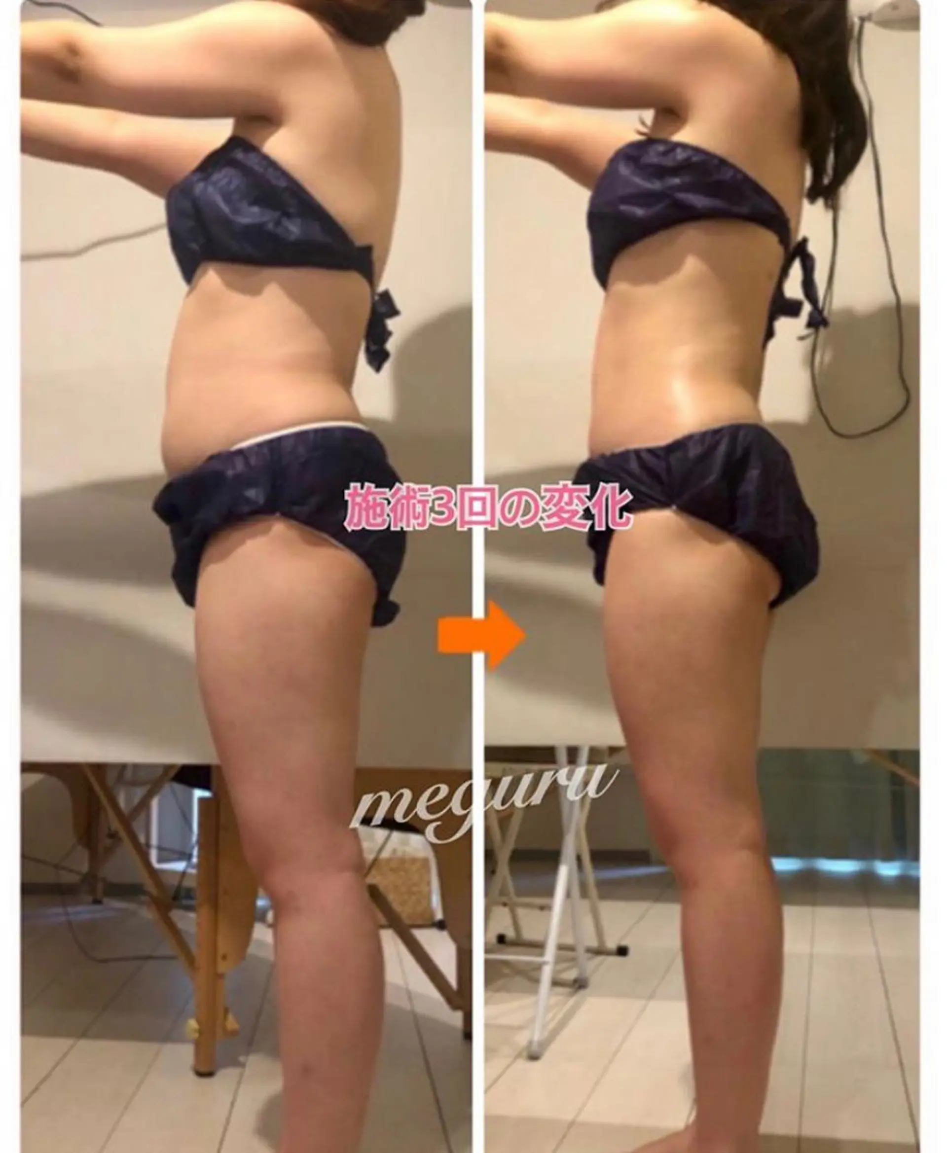 ショート カラー パーマ ヘアアレンジ メンズ キッズ ネイル マツエク・マツパ エステ リラク ‍痩身＆ボディ 結果出し🌟丹野のエステ・リラクイメージ