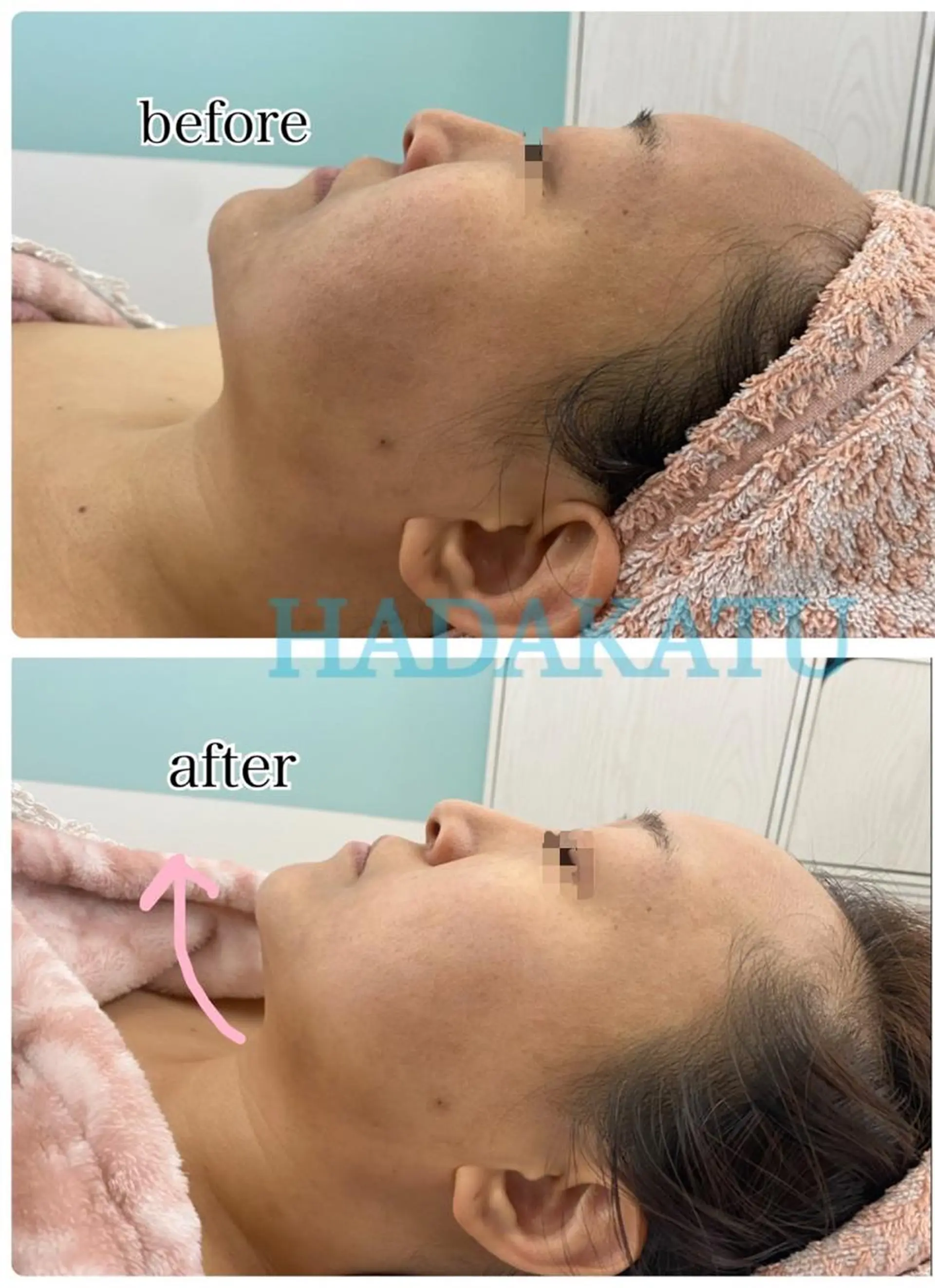 総合エステサロン 肌活のエステ・リラクイメージ