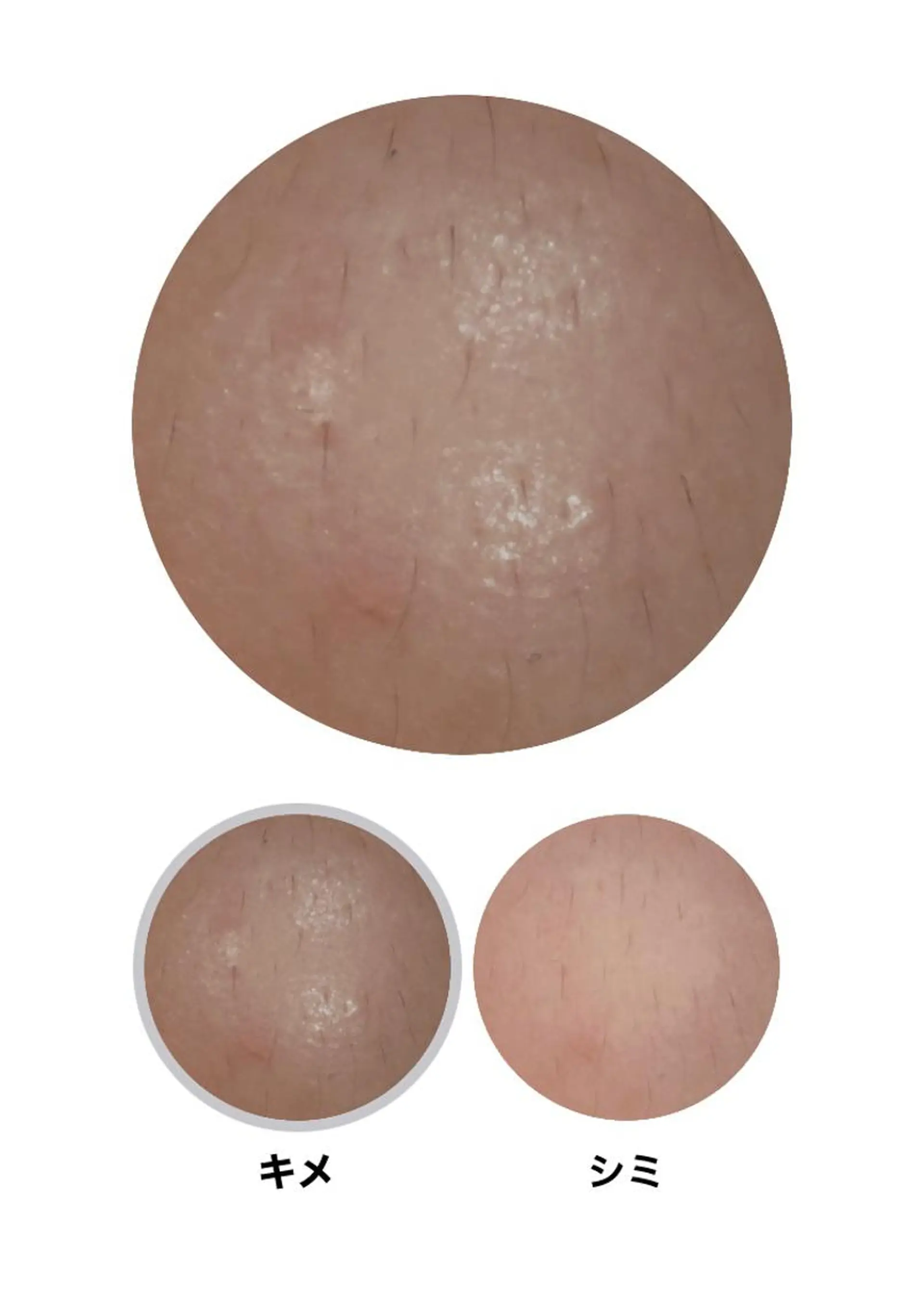 エステ メナード天王寺駅東口 稲冨恵美のエステ・リラクイメージ