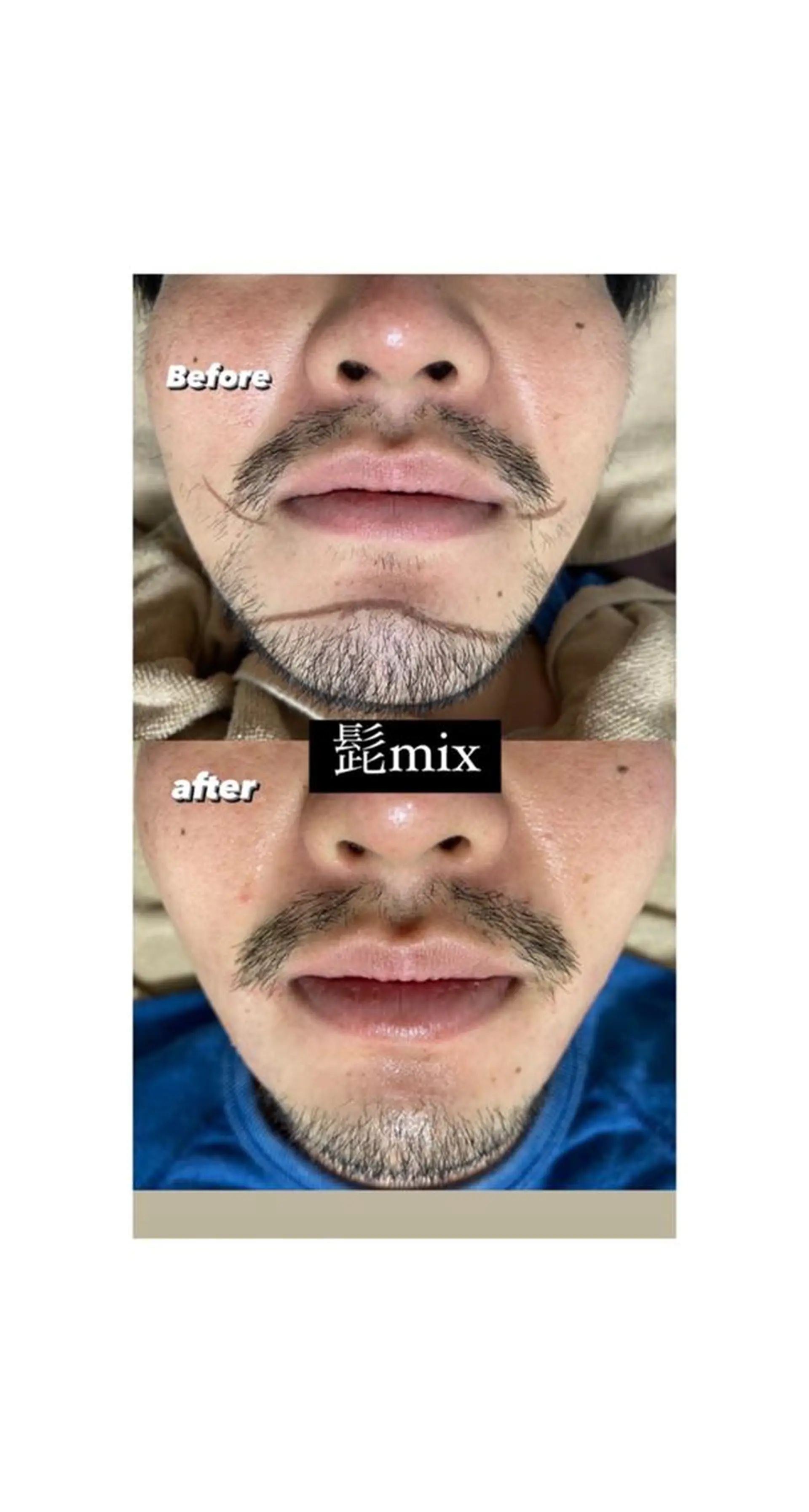 ショート 脱毛 Epina 千葉店 【エピナ】のエステ・リラクイメージ