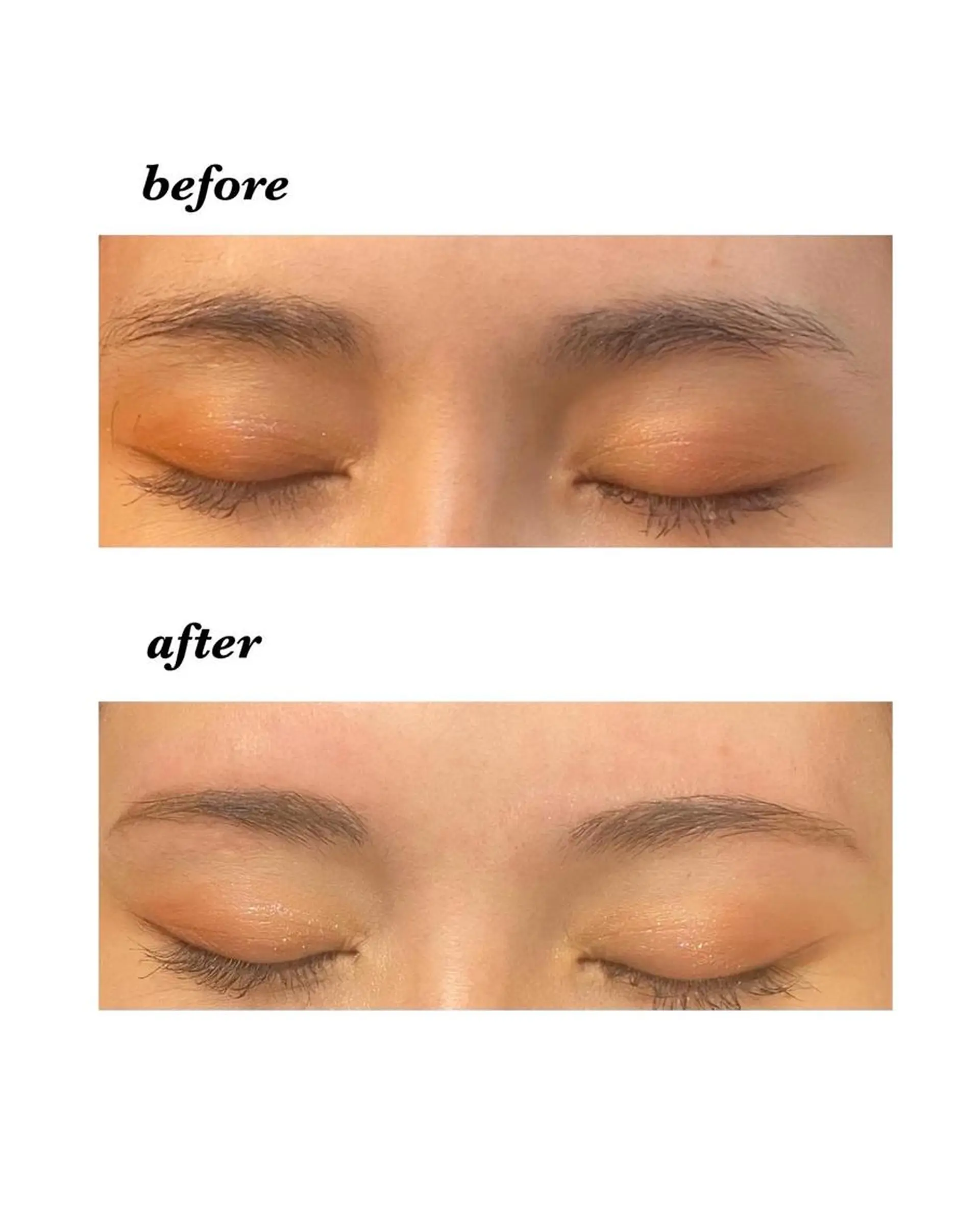 アイブロウ ハーブピーリング/韓国肌管理/フェイシャル/毛穴洗浄/眉毛/顔脱毛【糸脱毛専門】rev所属・ハーブピーリング専門 毛穴洗浄❤️眉waxのエステ・リラクイメージ