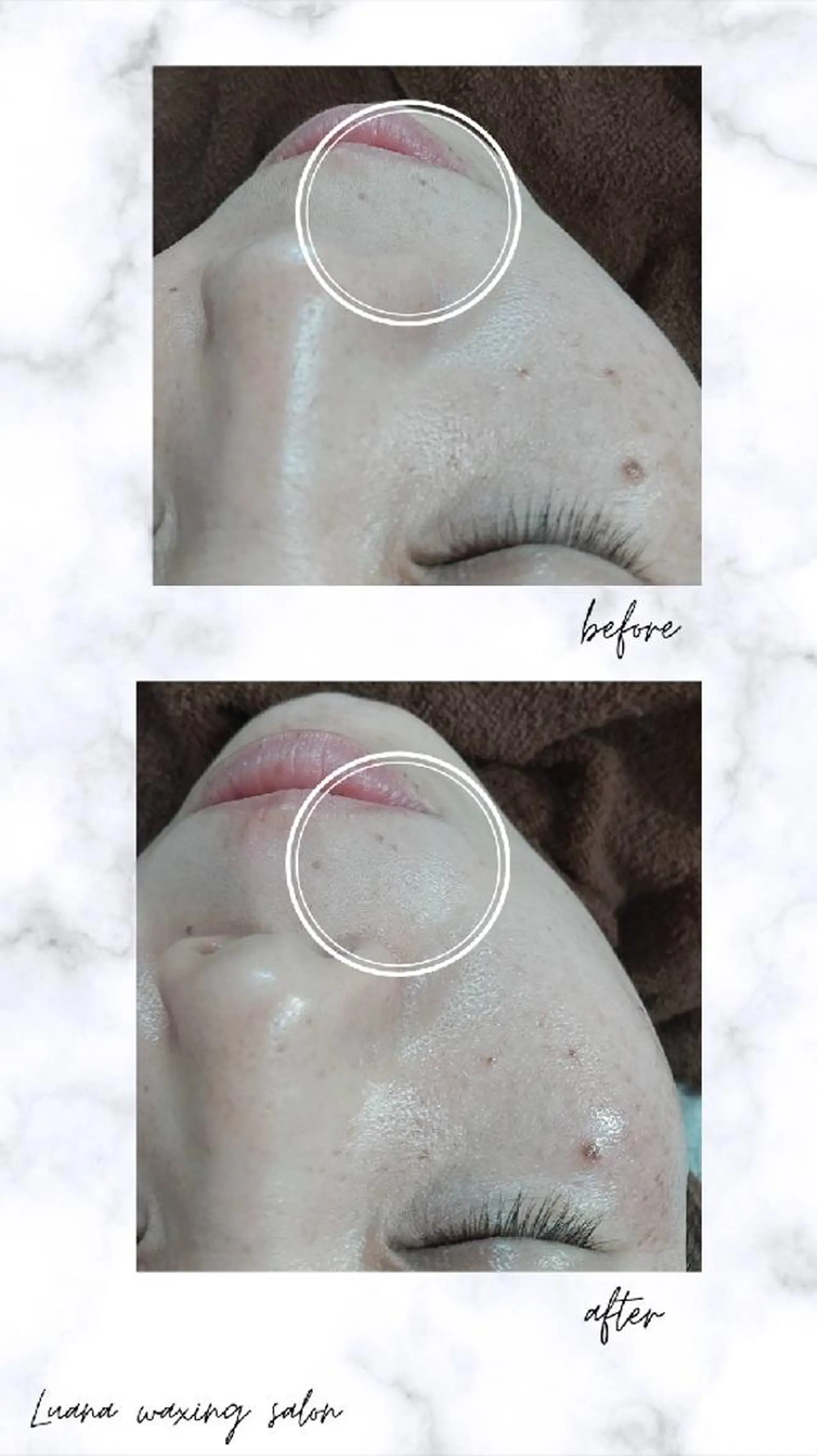 Luana wax 🐚根本のエステ・リラクイメージ