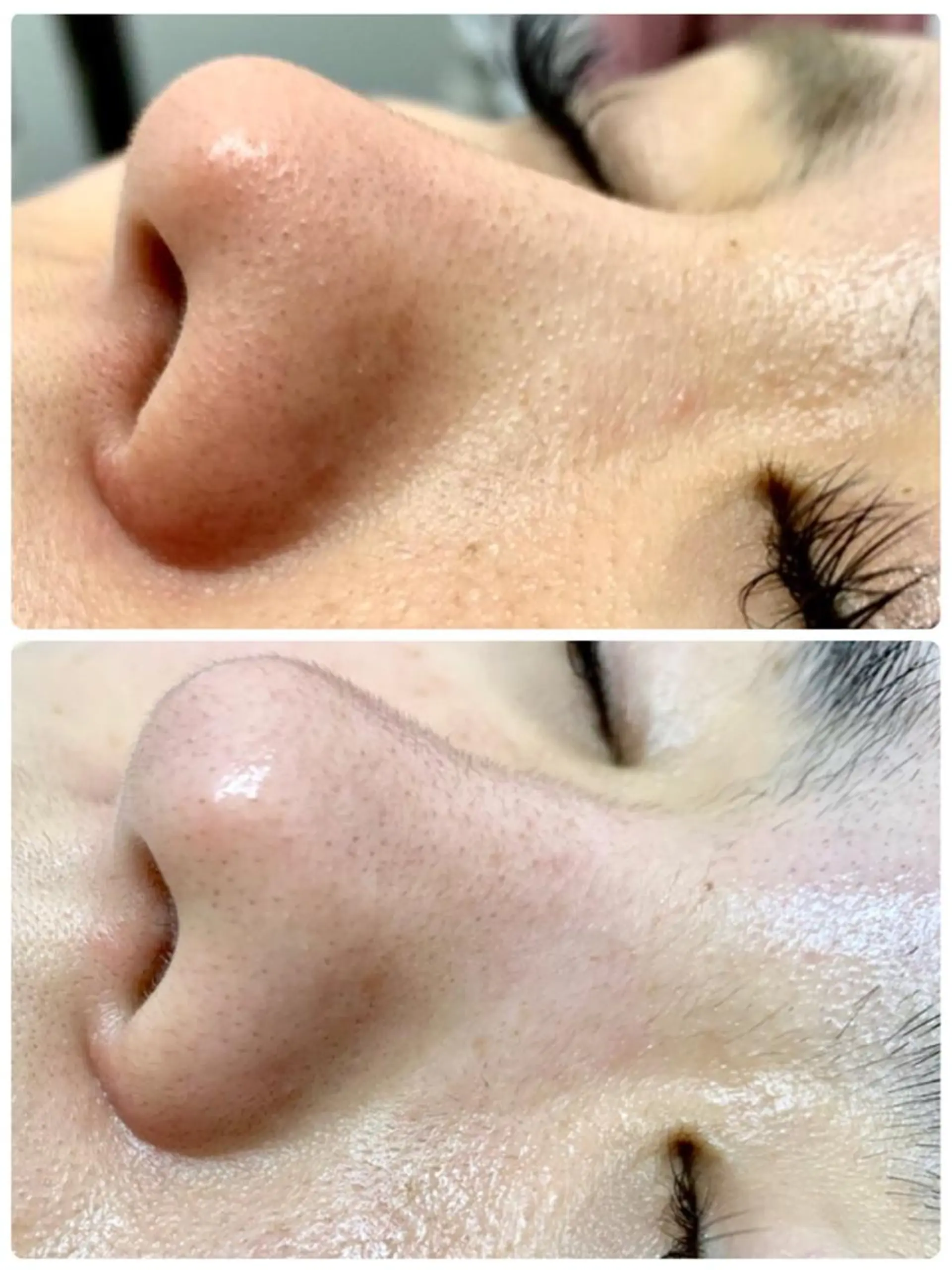 ハーブピーリングMB eautySalonのエステ・リラクイメージ