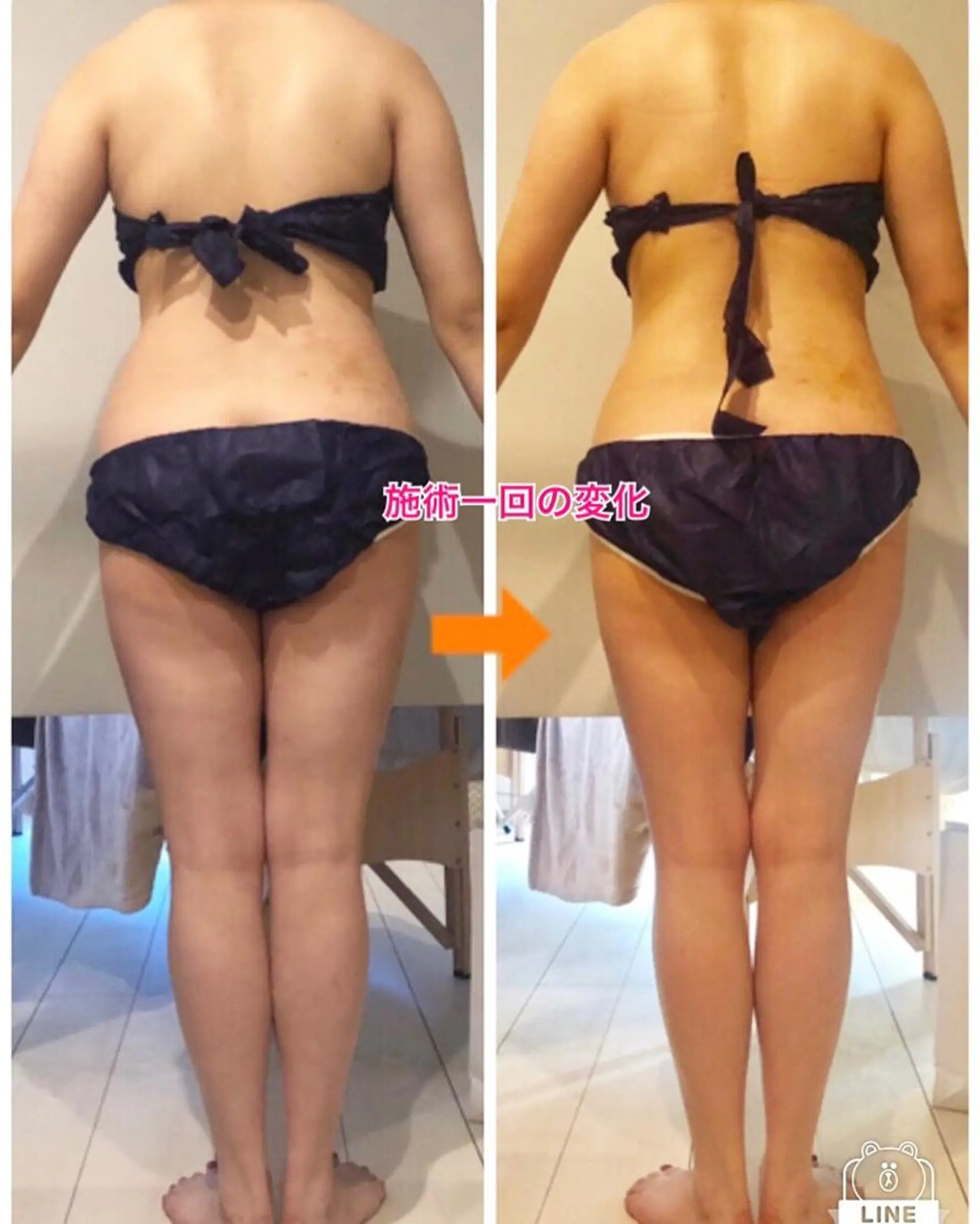 ショート カラー パーマ ヘアアレンジ メンズ キッズ ネイル マツエク・マツパ ‍痩身＆ボディ 結果出し🌟丹野のエステ・リラクイメージ