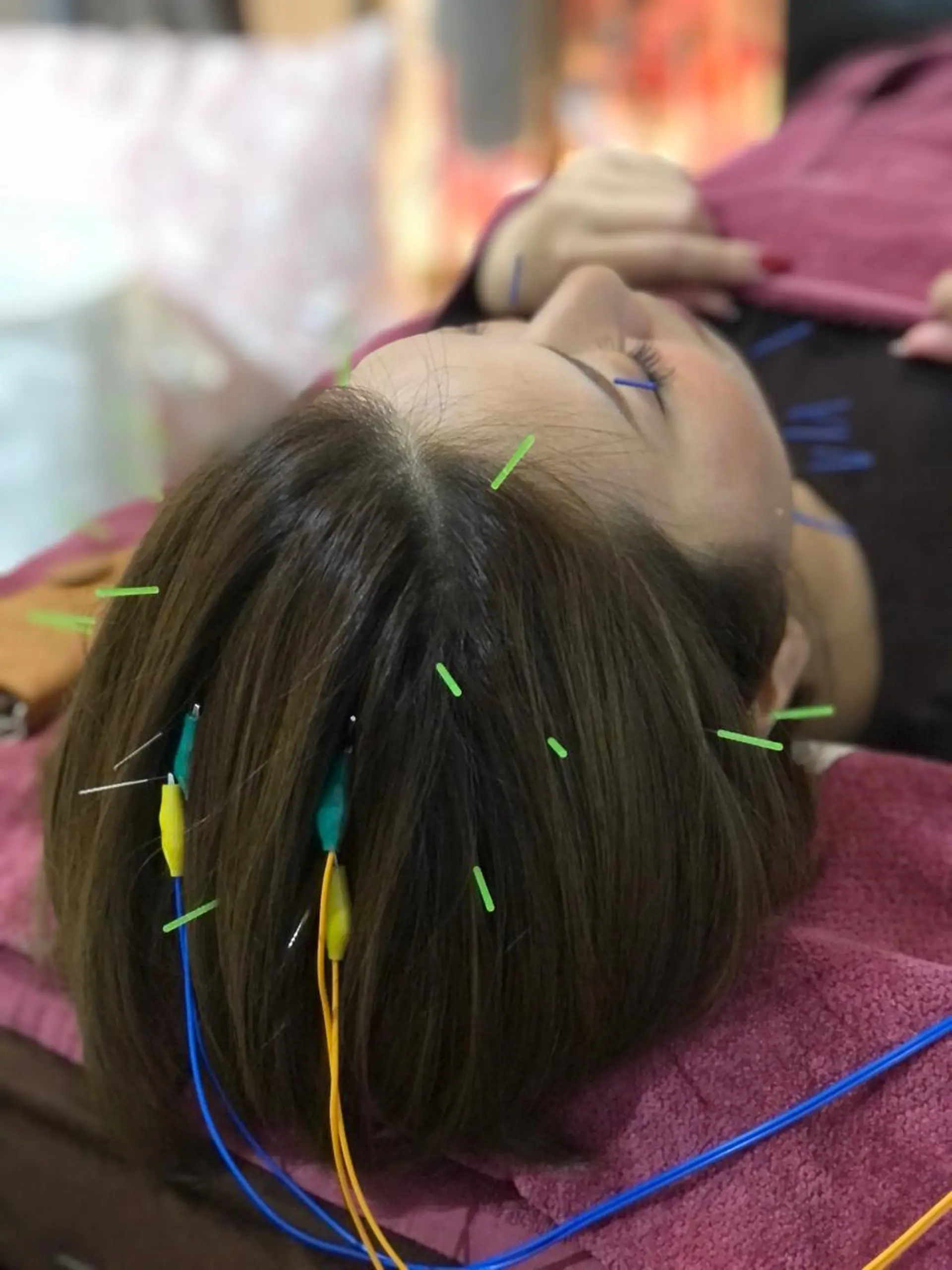 エステ リラク 美容鍼灸女性専用 りんご鍼灸治療院のその他イメージ