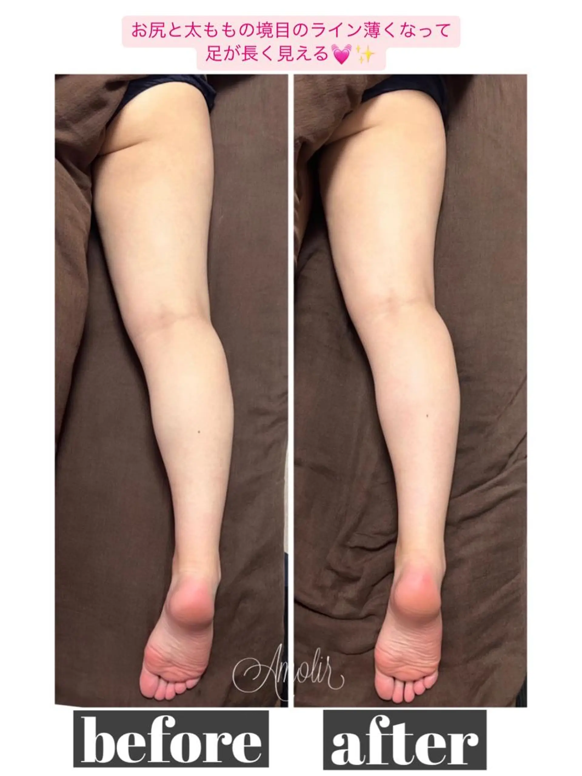 ボディメイクエステ Amolirのエステ・リラクイメージ