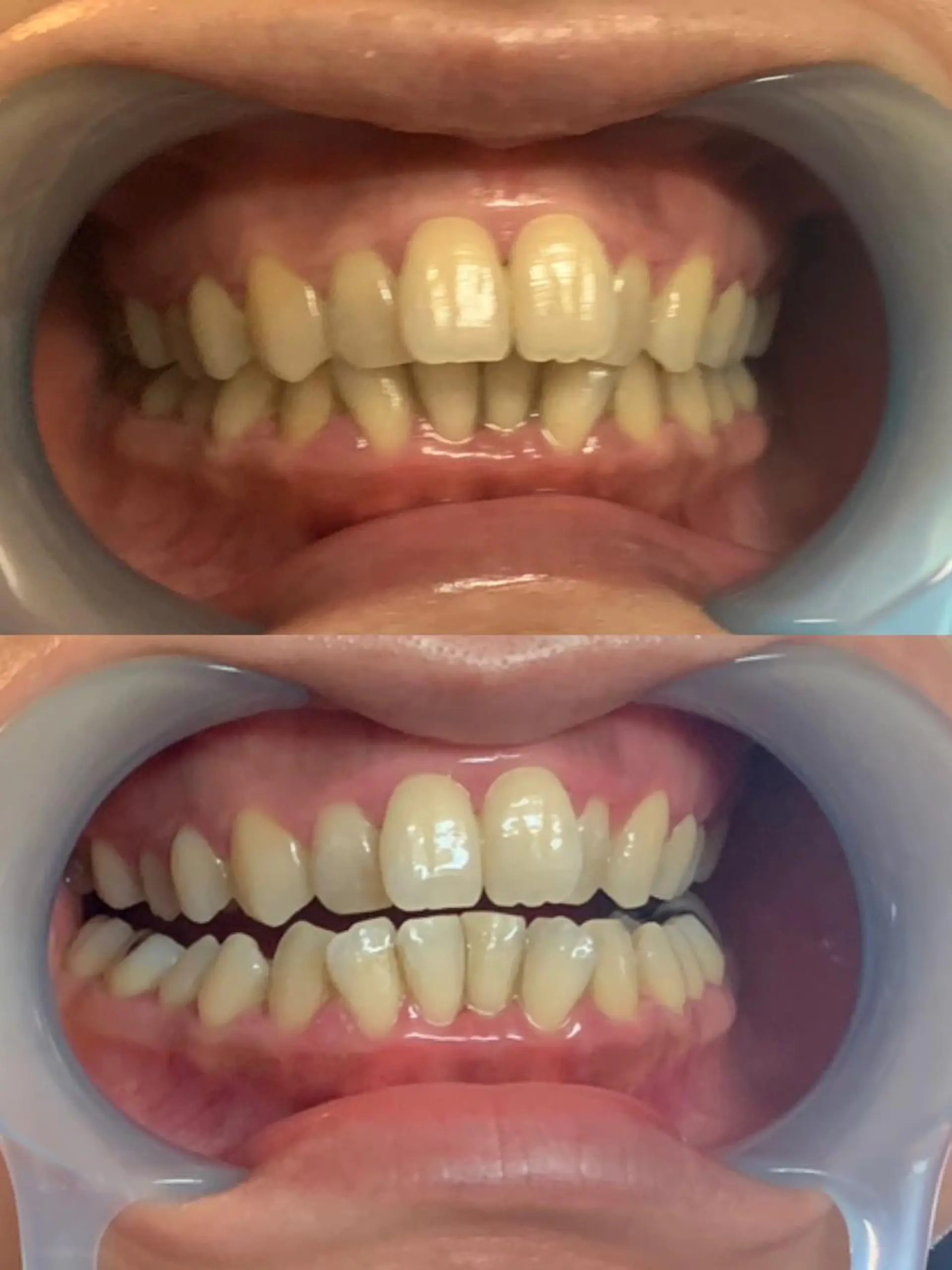 その他 Lyf salon.のエステ・リラクイメージ