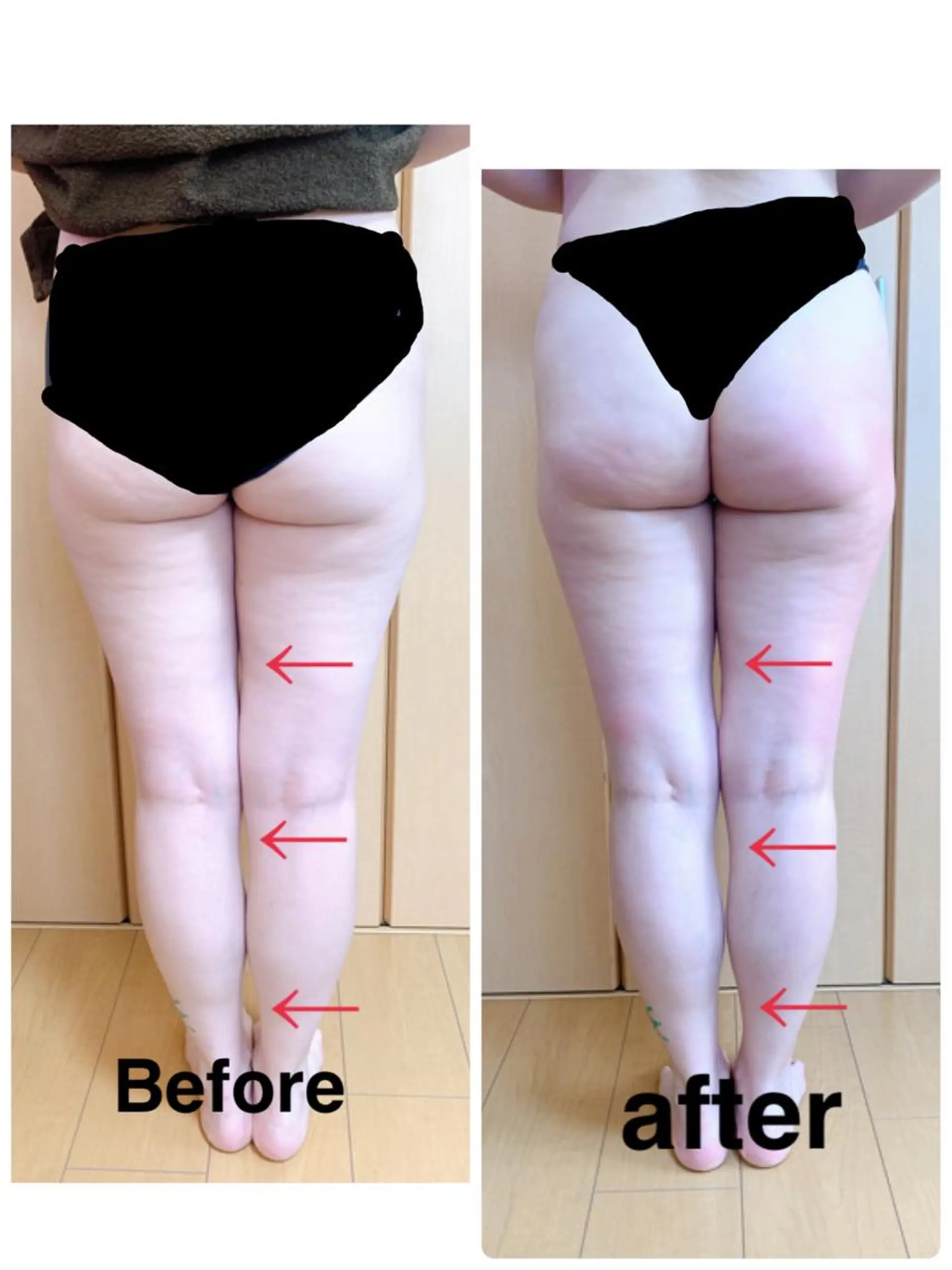 痩身/脱毛/ネイル HARUKAのエステ・リラクイメージ