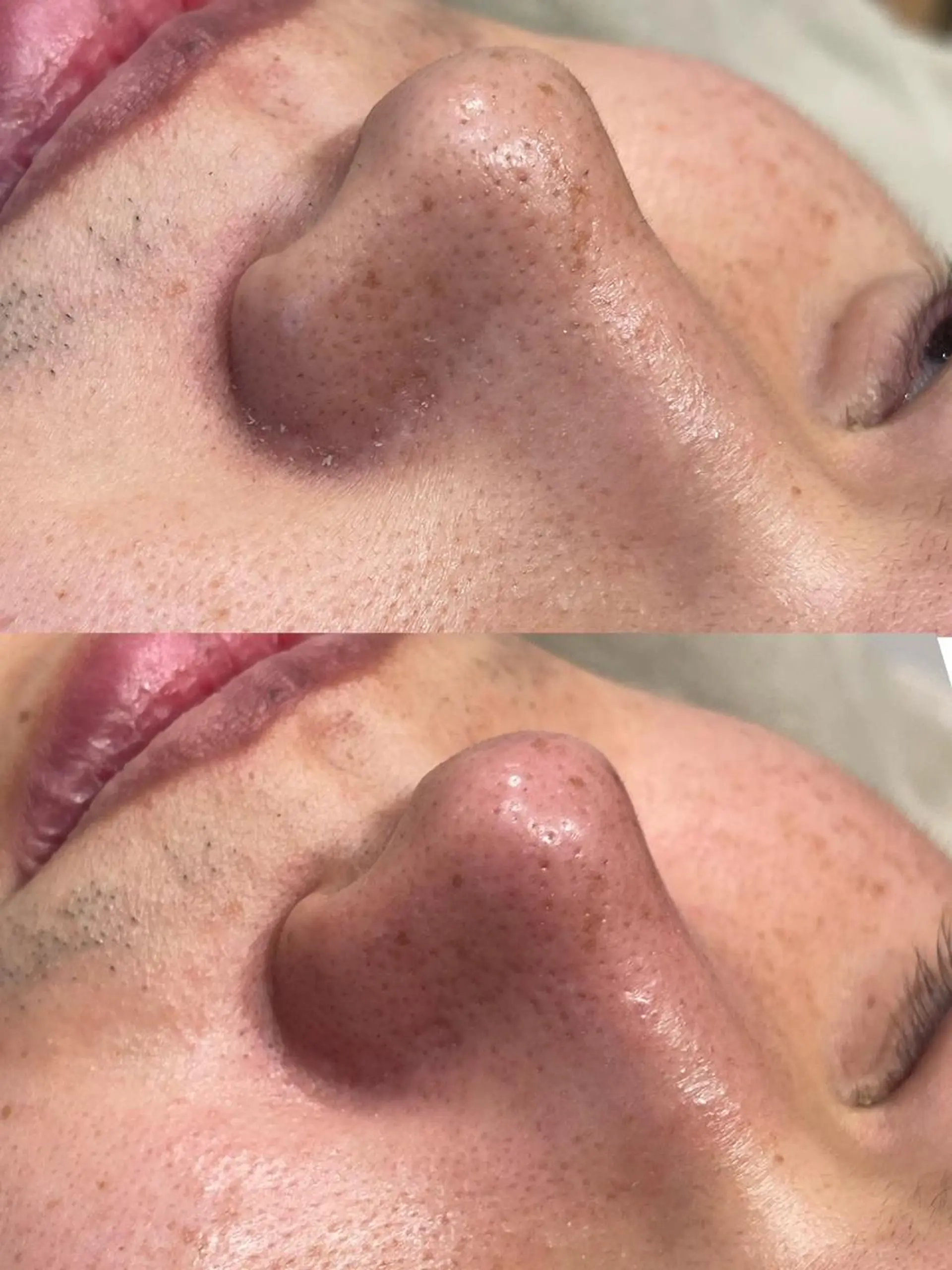 エステ NACHUL MANAのその他イメージ