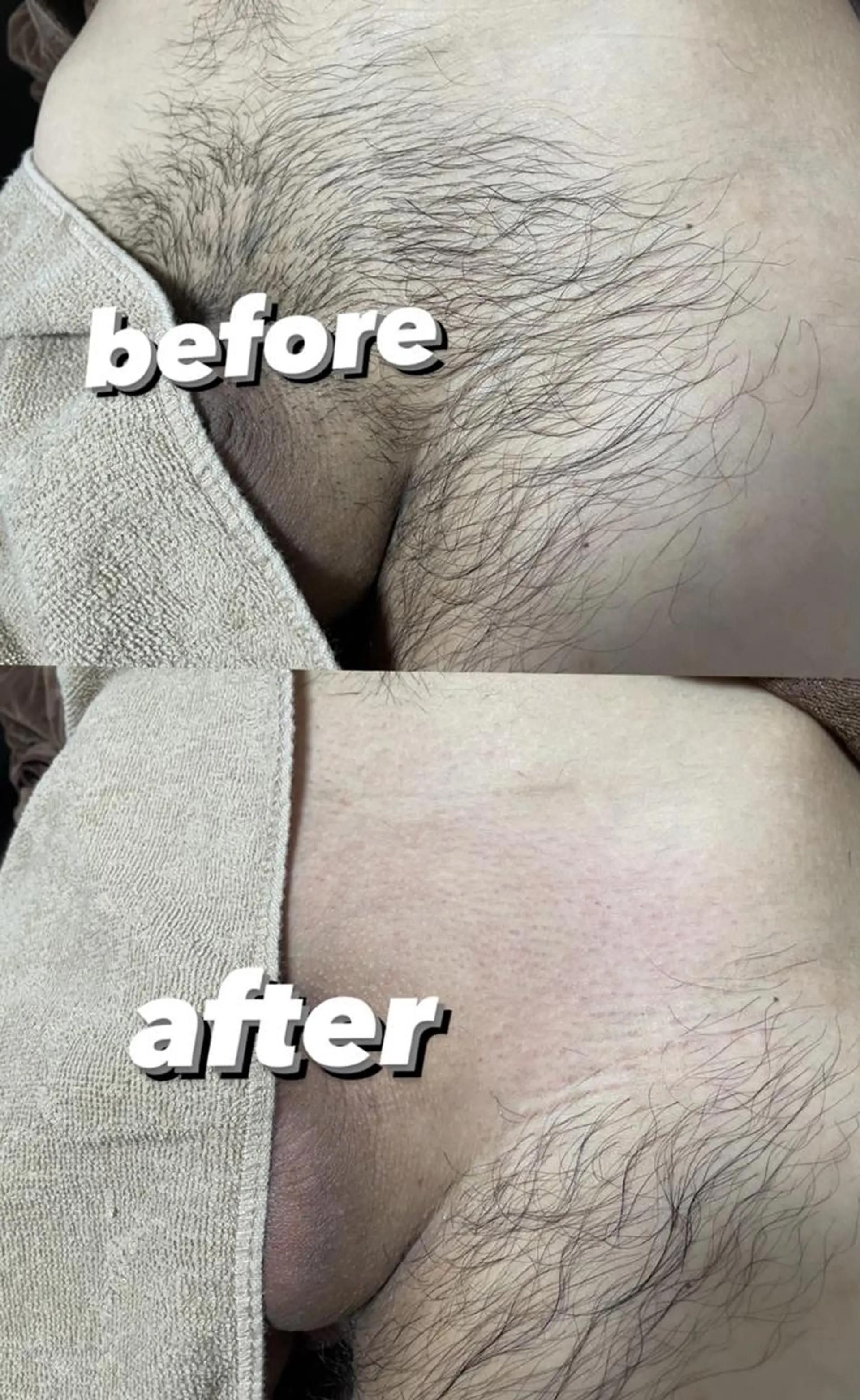 メンズ キッズ 脱毛 Epina 千葉店 【エピナ】のエステ・リラクイメージ