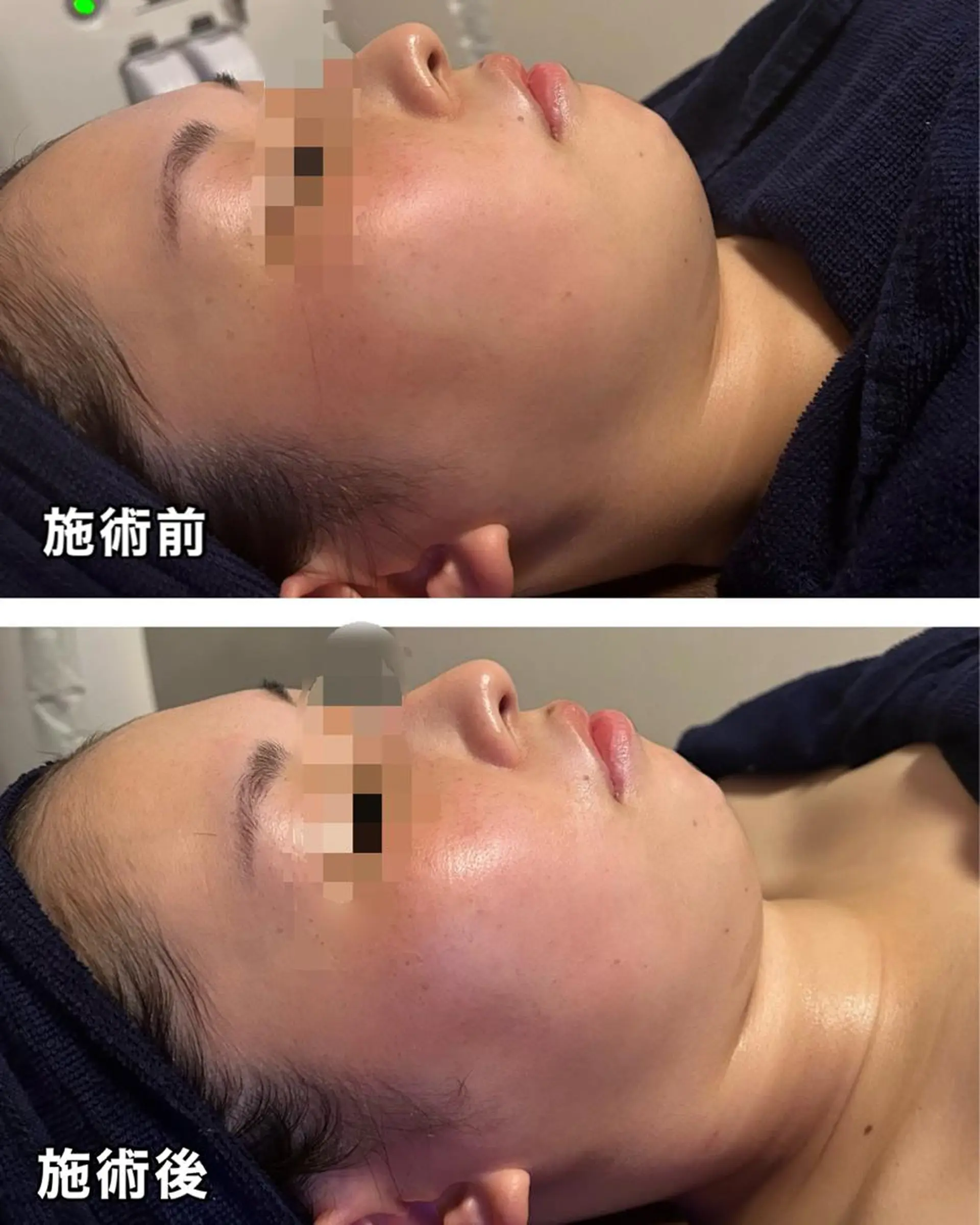 🌴Beauty Salon LANAのエステ・リラクイメージ