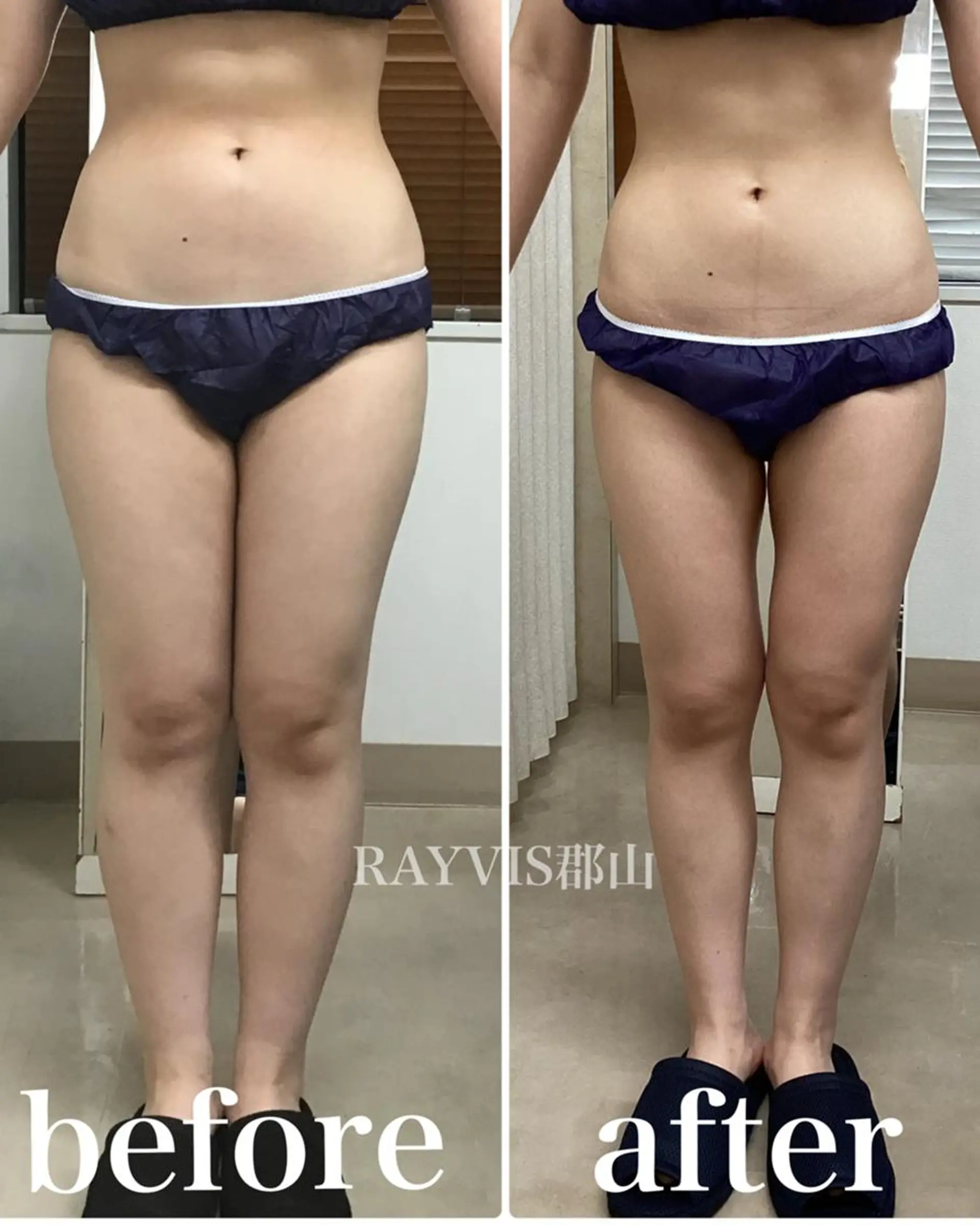 RAYVIS 郡山店のエステ・リラクイメージ