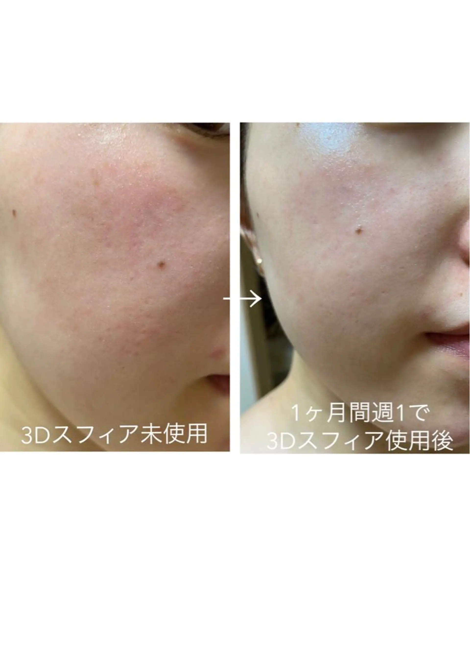 エステ 西田 愛花のエステ・リラクイメージ