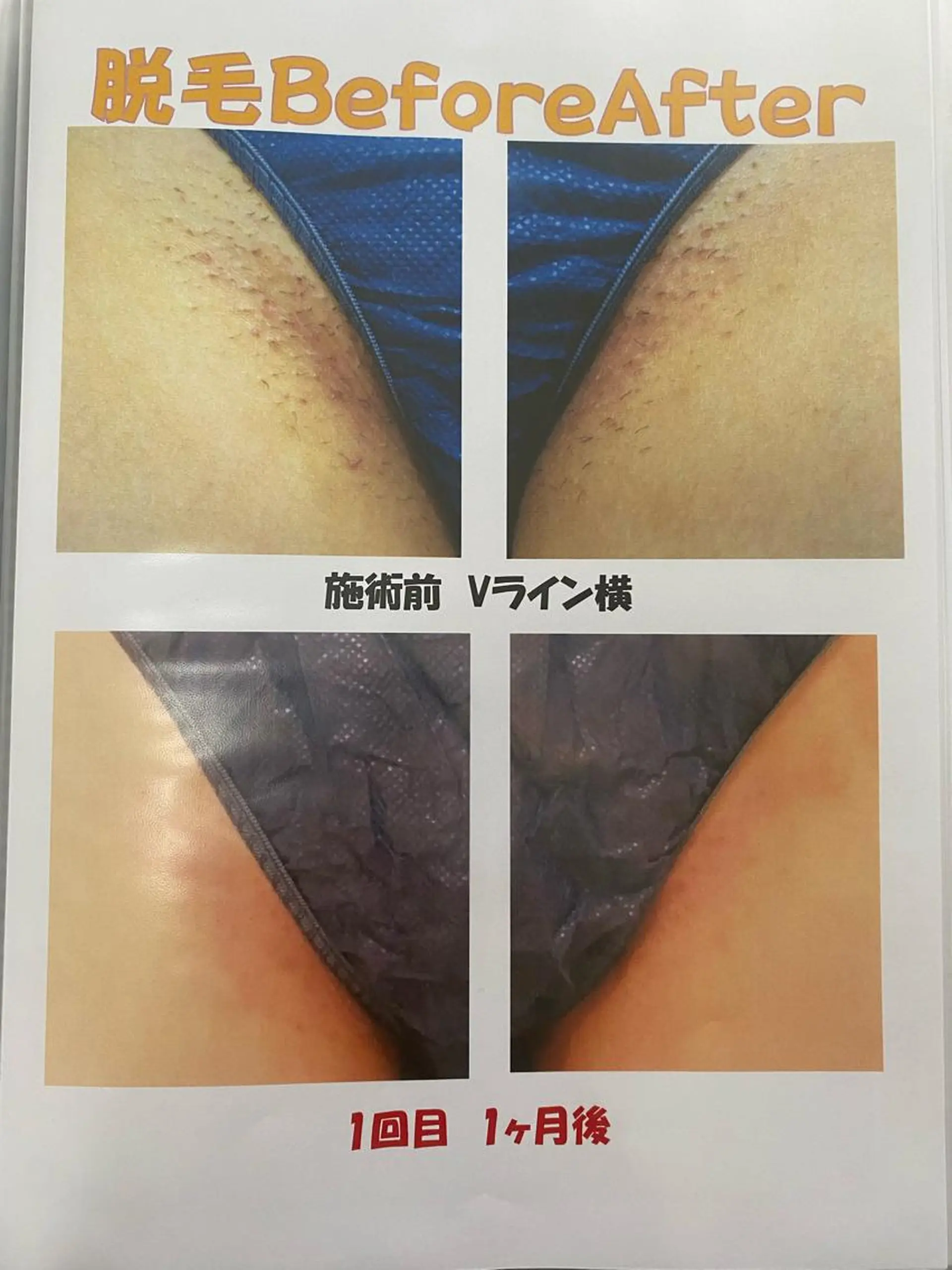 痩身リラク専門サロン 〜LUCIALL 〜のエステ・リラクイメージ