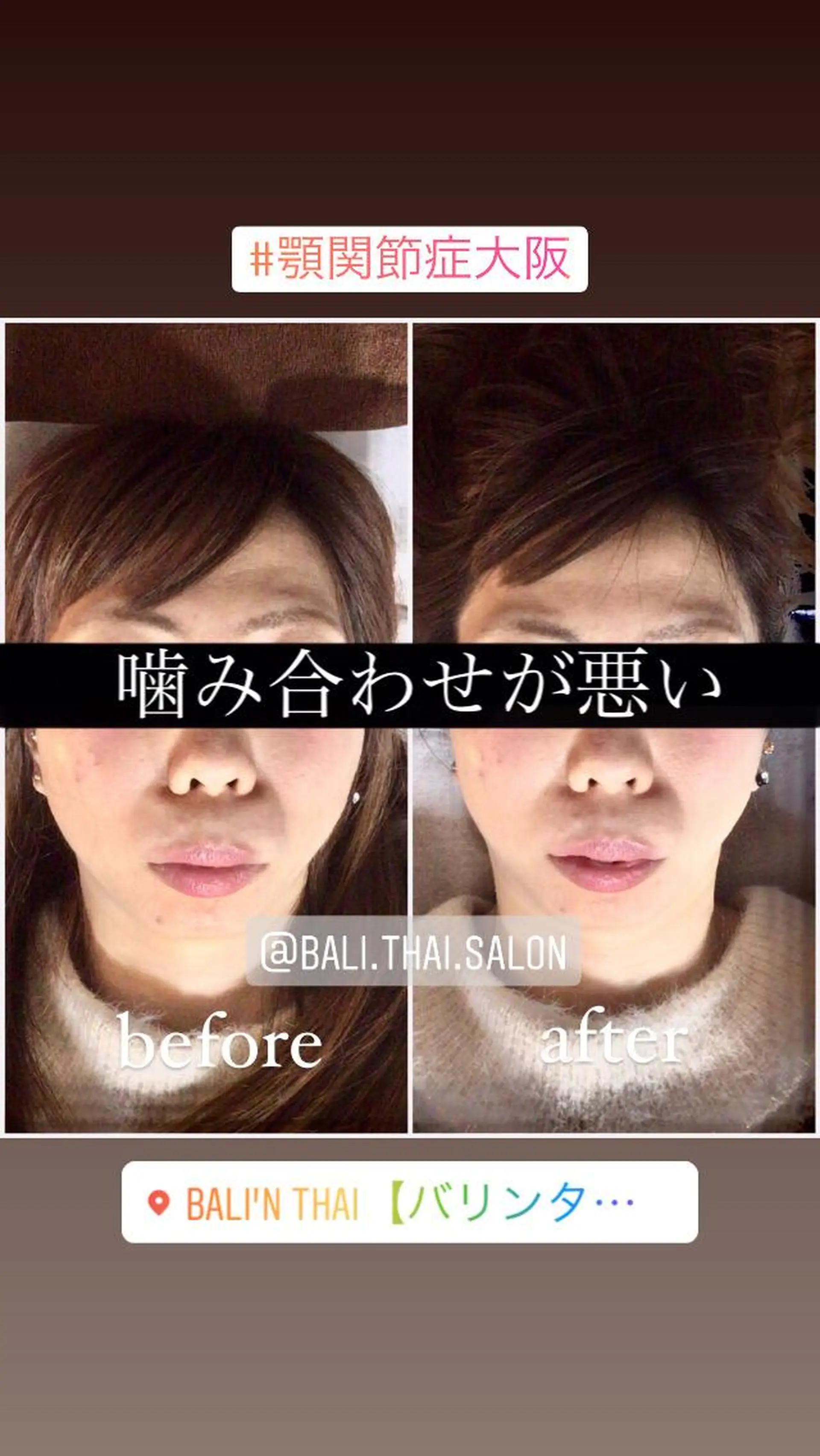 🌈歪み改善🌈 バリンタイ すぎうらのエステ・リラクイメージ