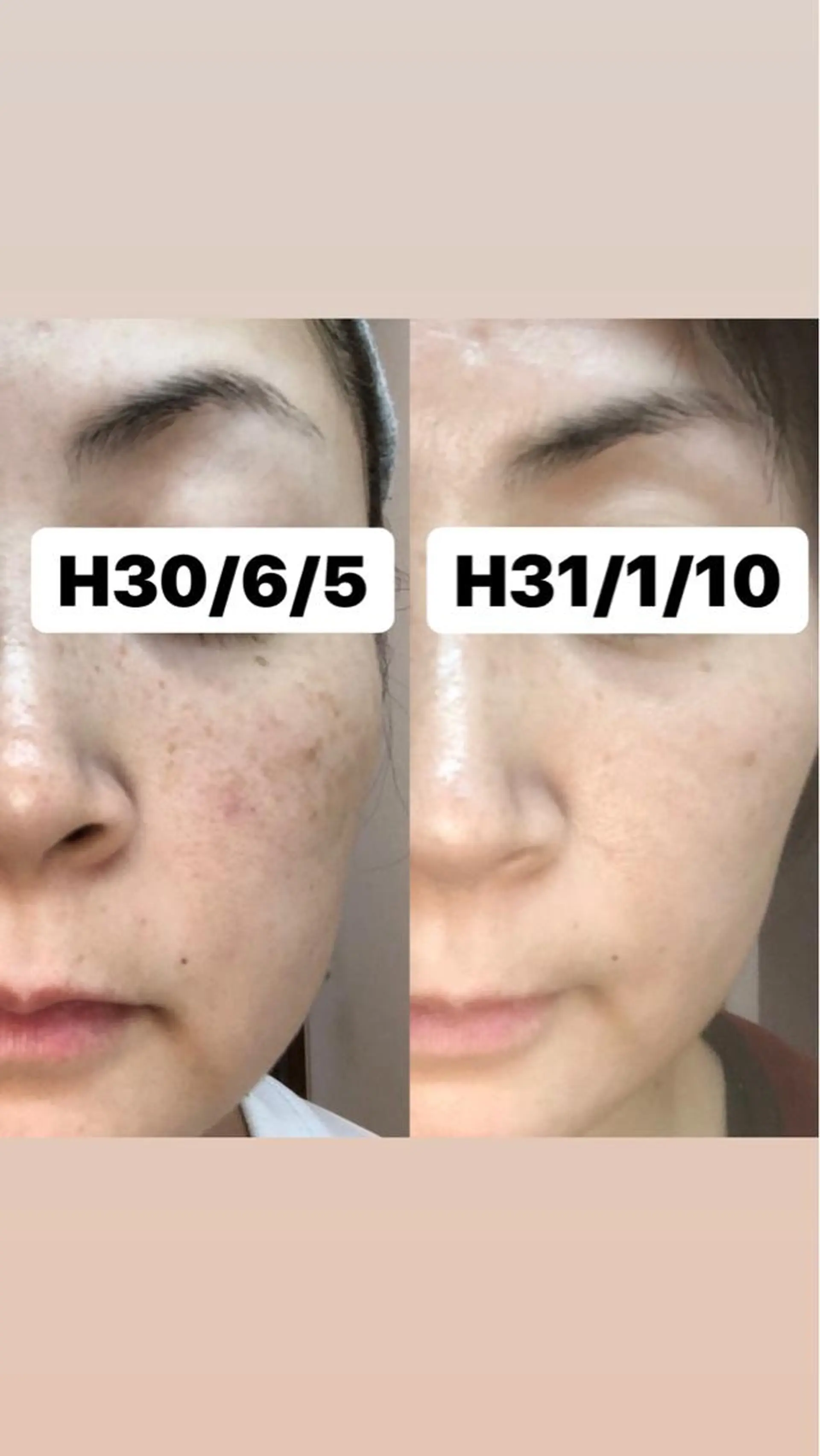 エステ ✨ナリス化粧品✨ Shinyのエステ・リラクイメージ