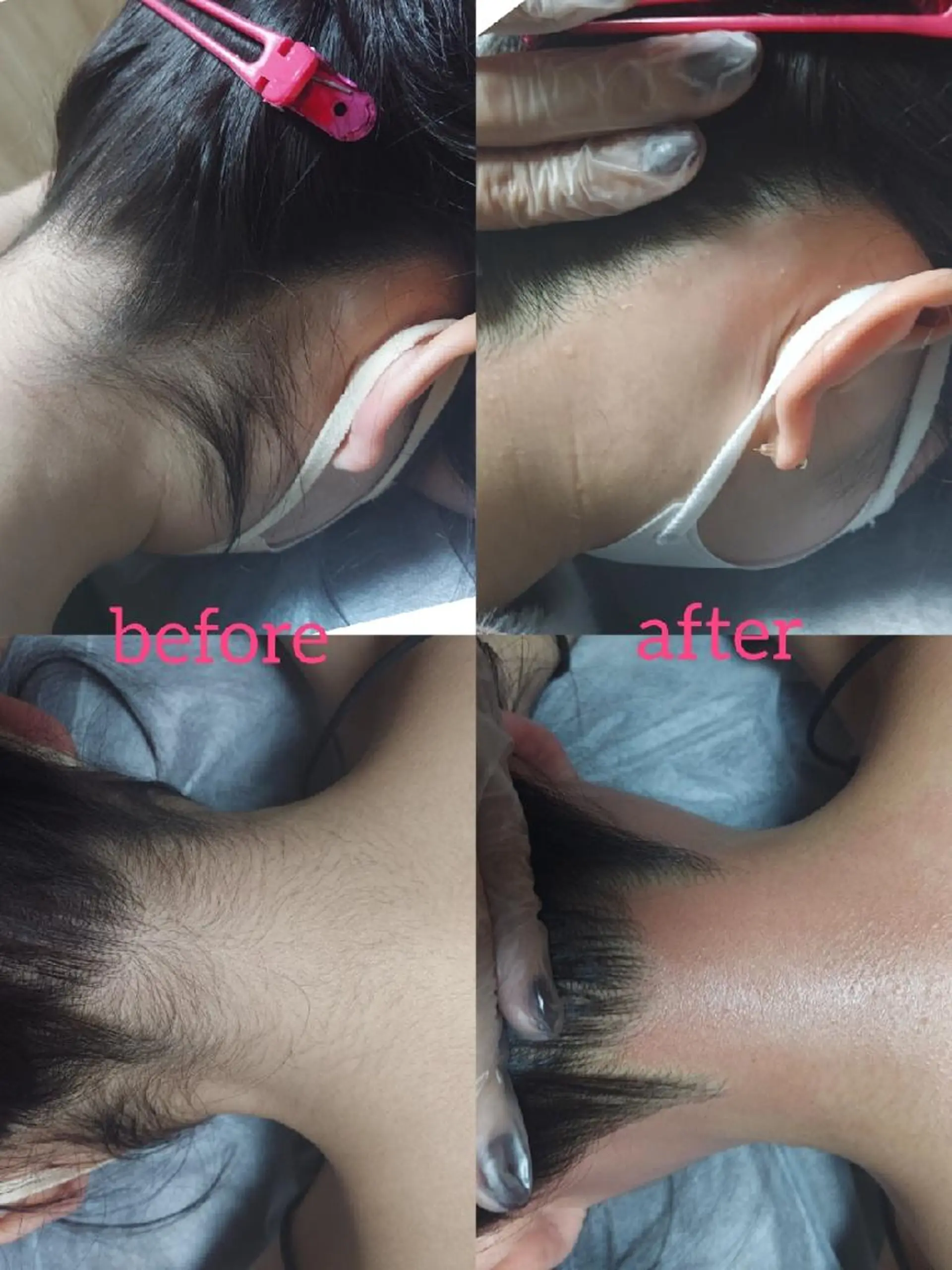 脱毛サロンLULA 恵比寿店濱野のエステ・リラクイメージ