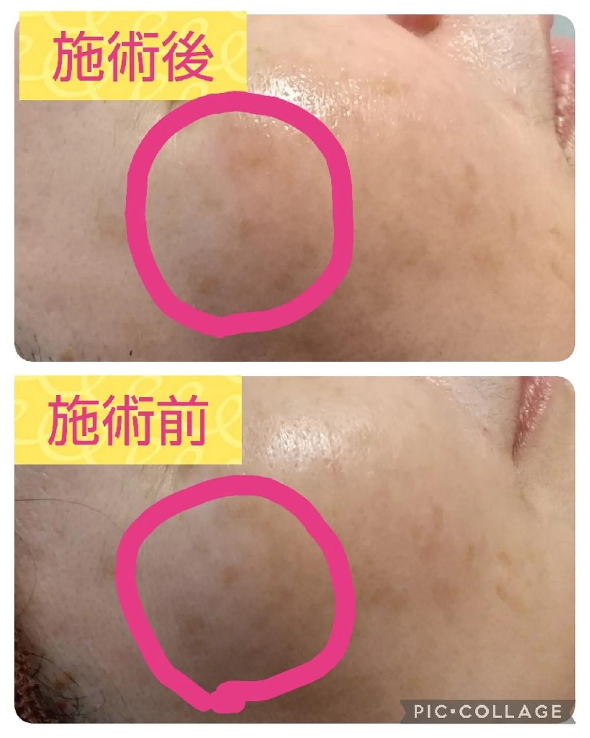 エステ viage所属・viage 脱毛&フェイシャル店のエステ・リラクイメージ