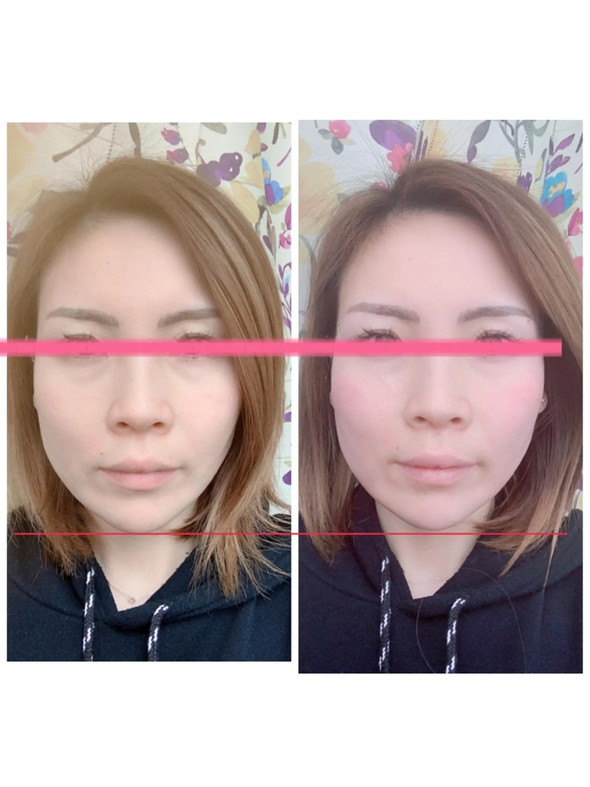 痩身/脱毛/ネイル HARUKAのエステ・リラクイメージ