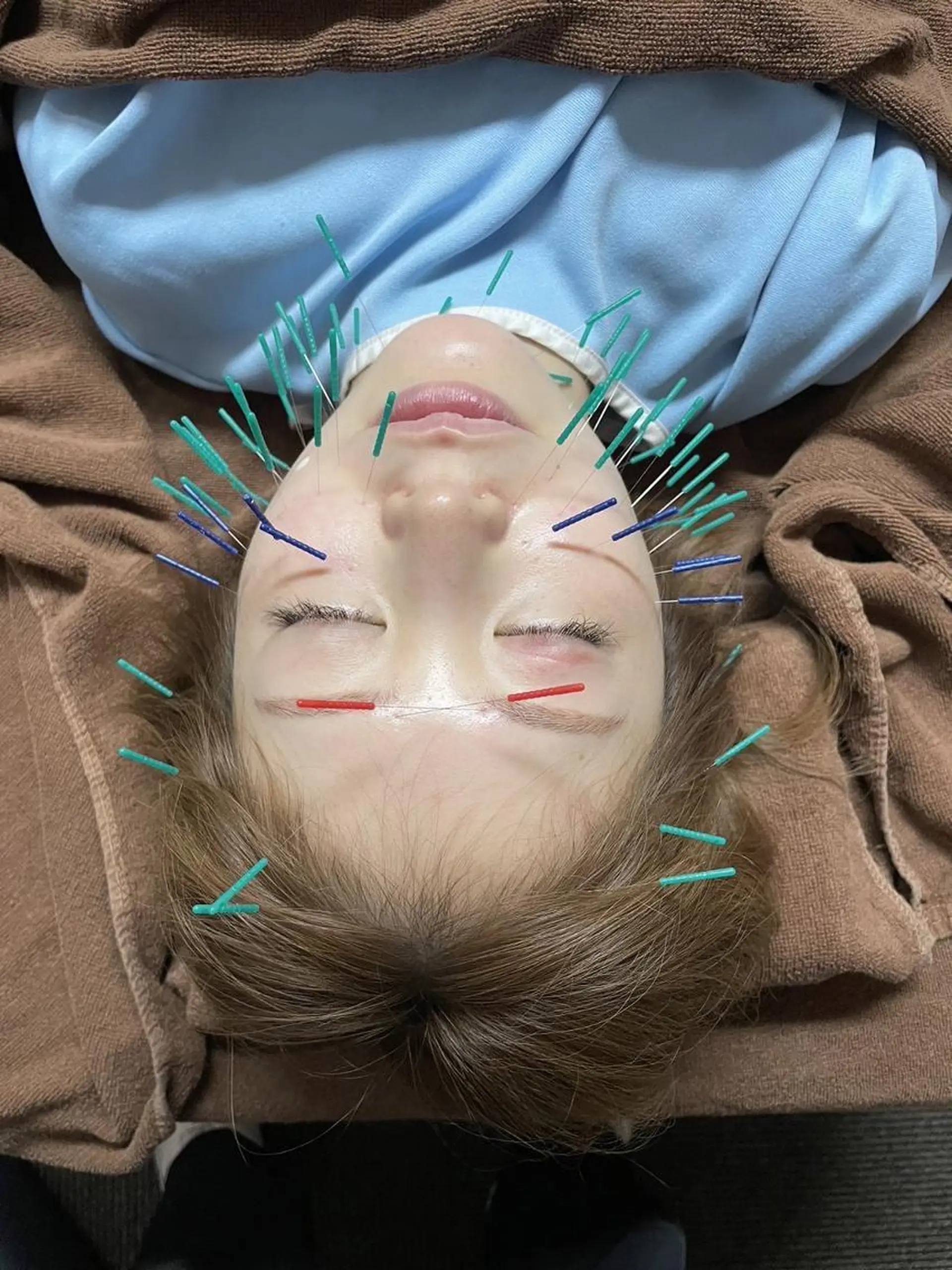 松本 考矢(鍼灸師)のエステ・リラクイメージ