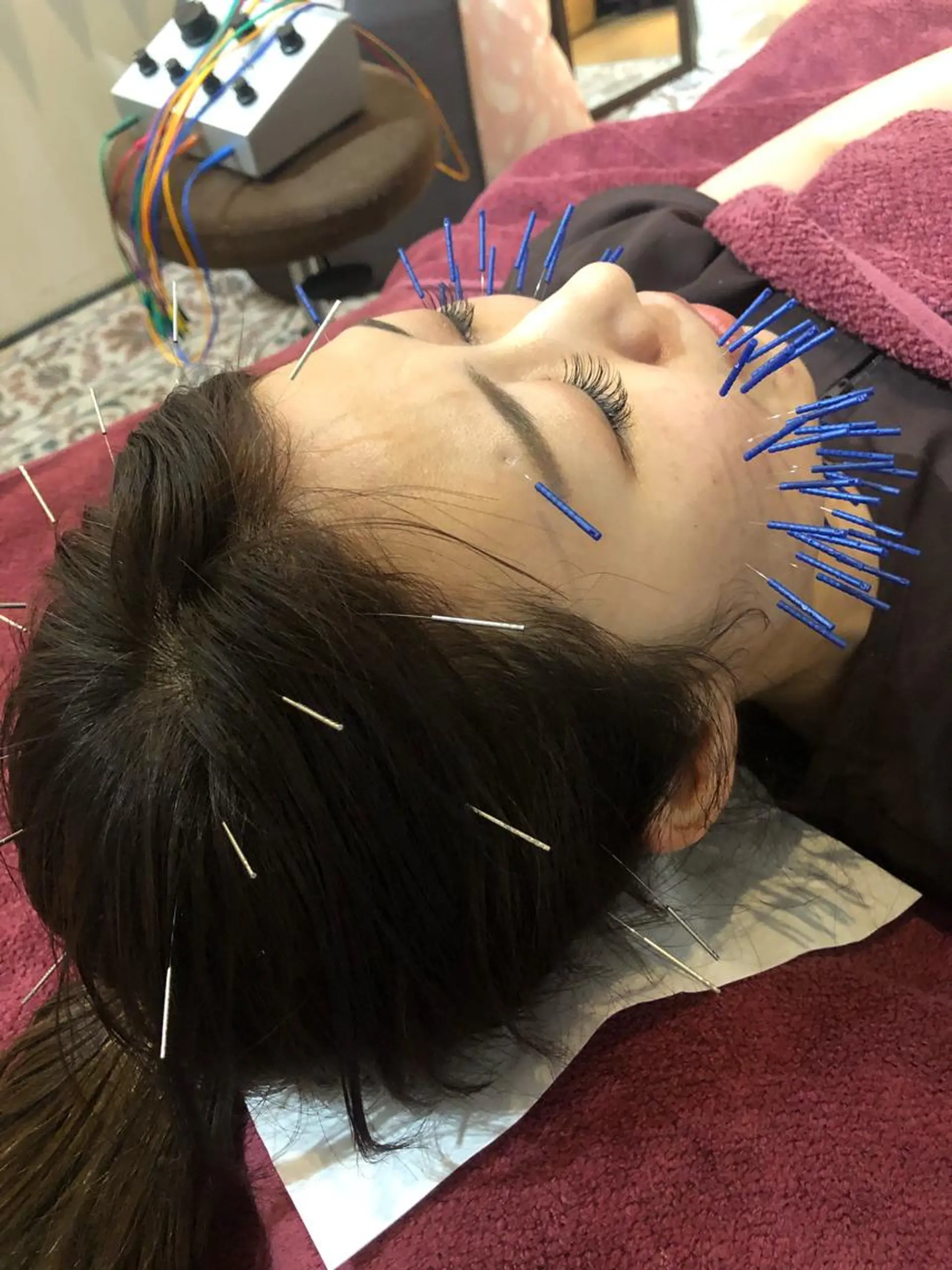 エステ リラク 美容鍼灸女性専用 りんご鍼灸治療院のその他イメージ