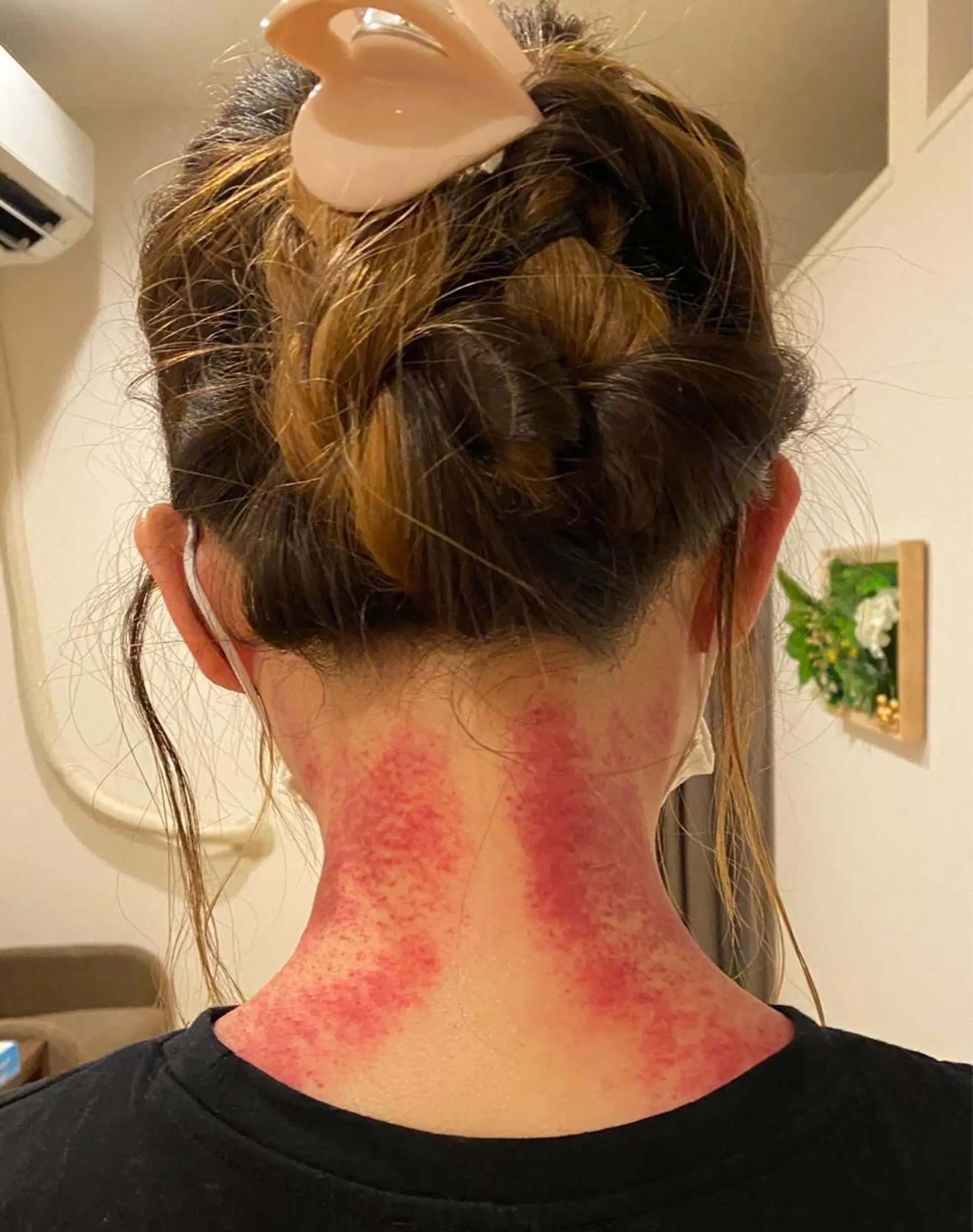 毛穴フェイシャル エステ専門店BBのエステ・リラクイメージ