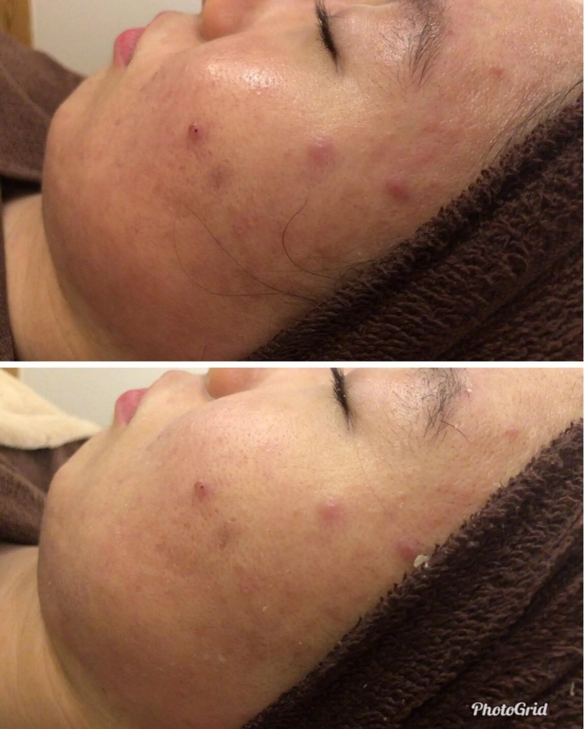 メンズ 金の糸脱毛 産毛ケア専門のエステ・リラクイメージ