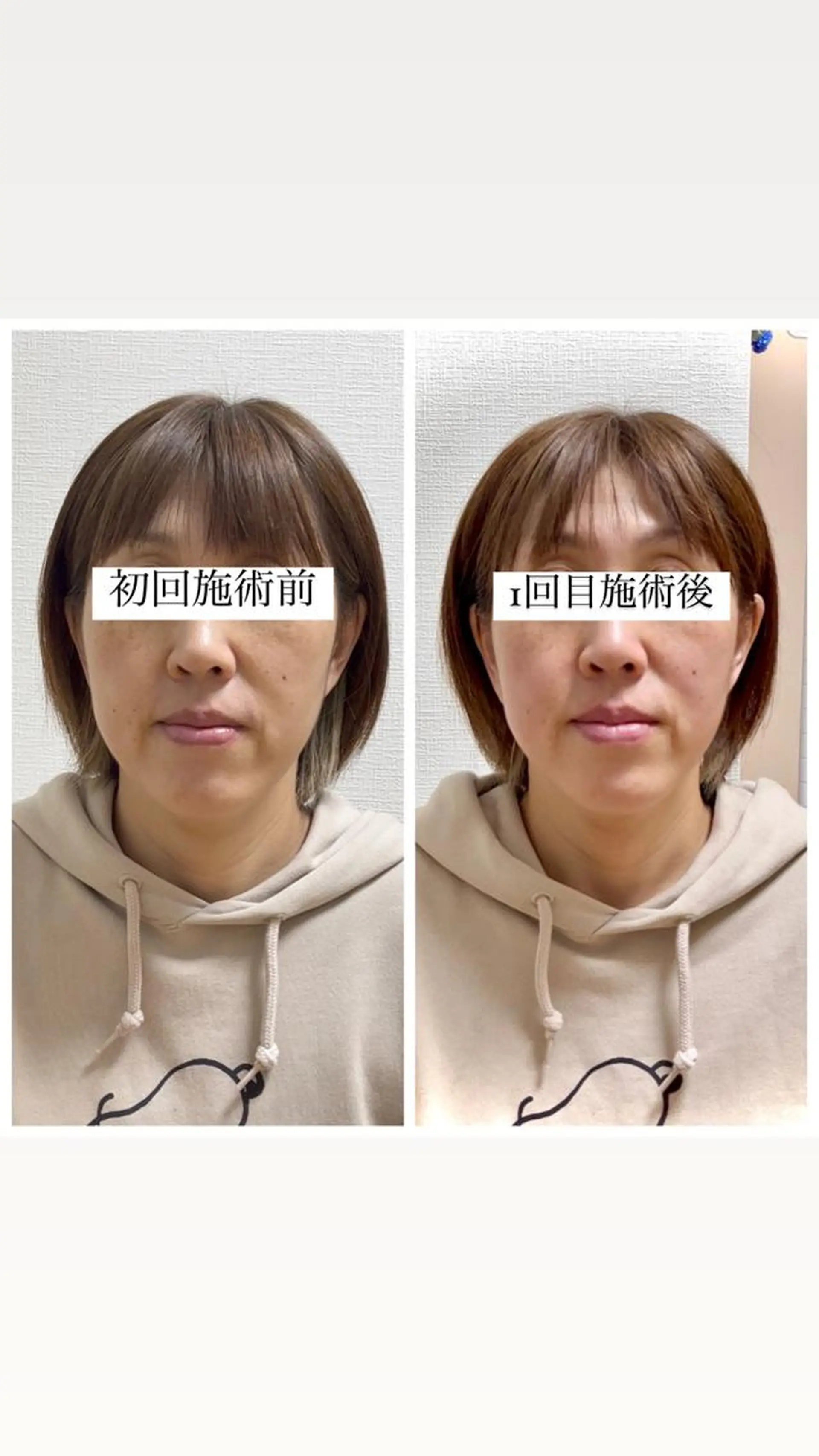 エクラヴィ 小顔・エイジングケアのエステ・リラクイメージ