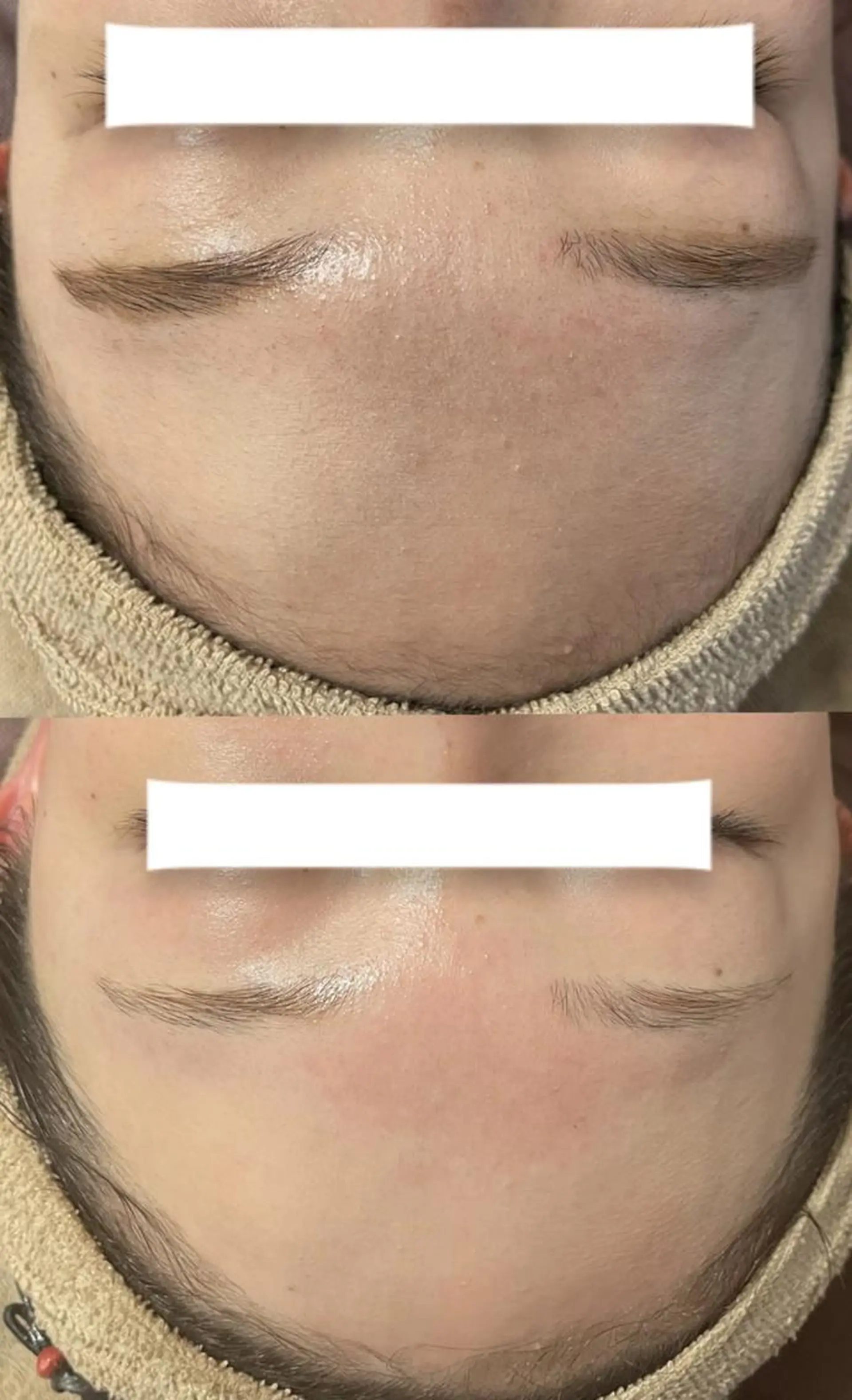 マツエク・マツパ キッズ メンズ アイブロウ 脱毛 Epina 千葉店 【エピナ】のエステ・リラクイメージ