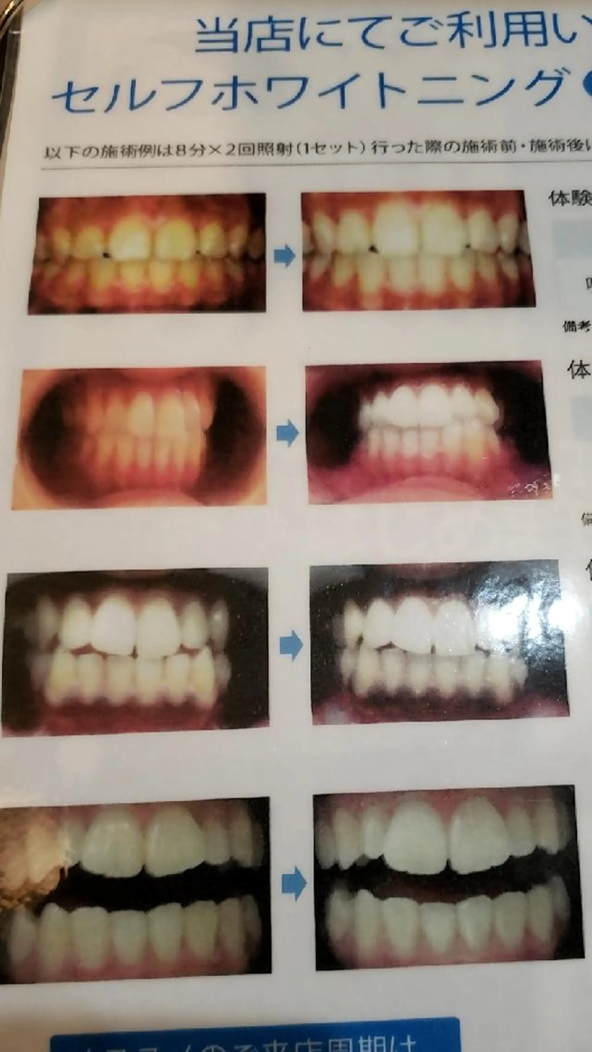 LASH BAR  友久のマツエク・マツパデザイン