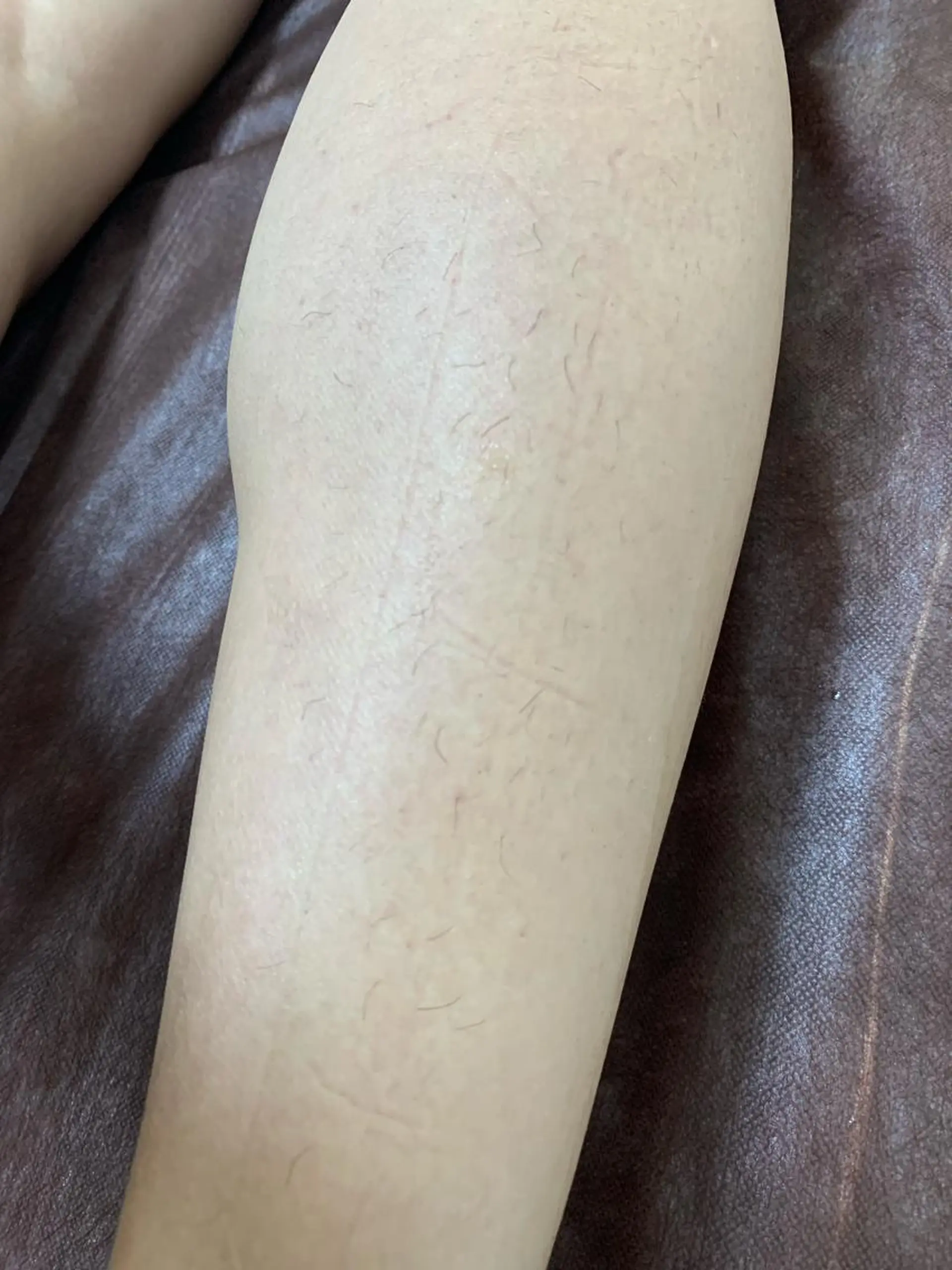 メンズ キッズ 脱毛SALON RaYNiCKのエステ・リラクイメージ