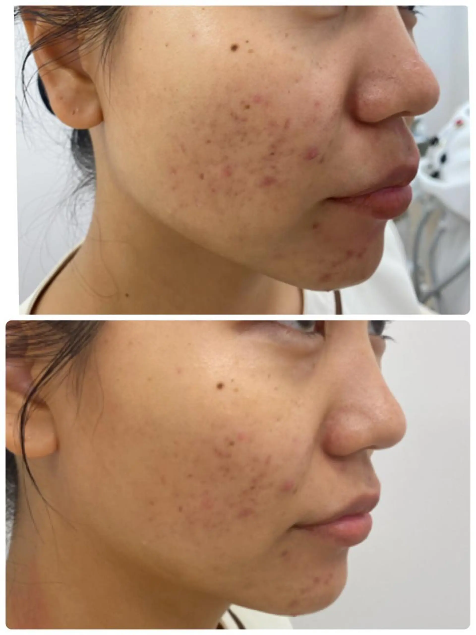 QANAEL所属・QANAEL 小山のエステ・リラクイメージ