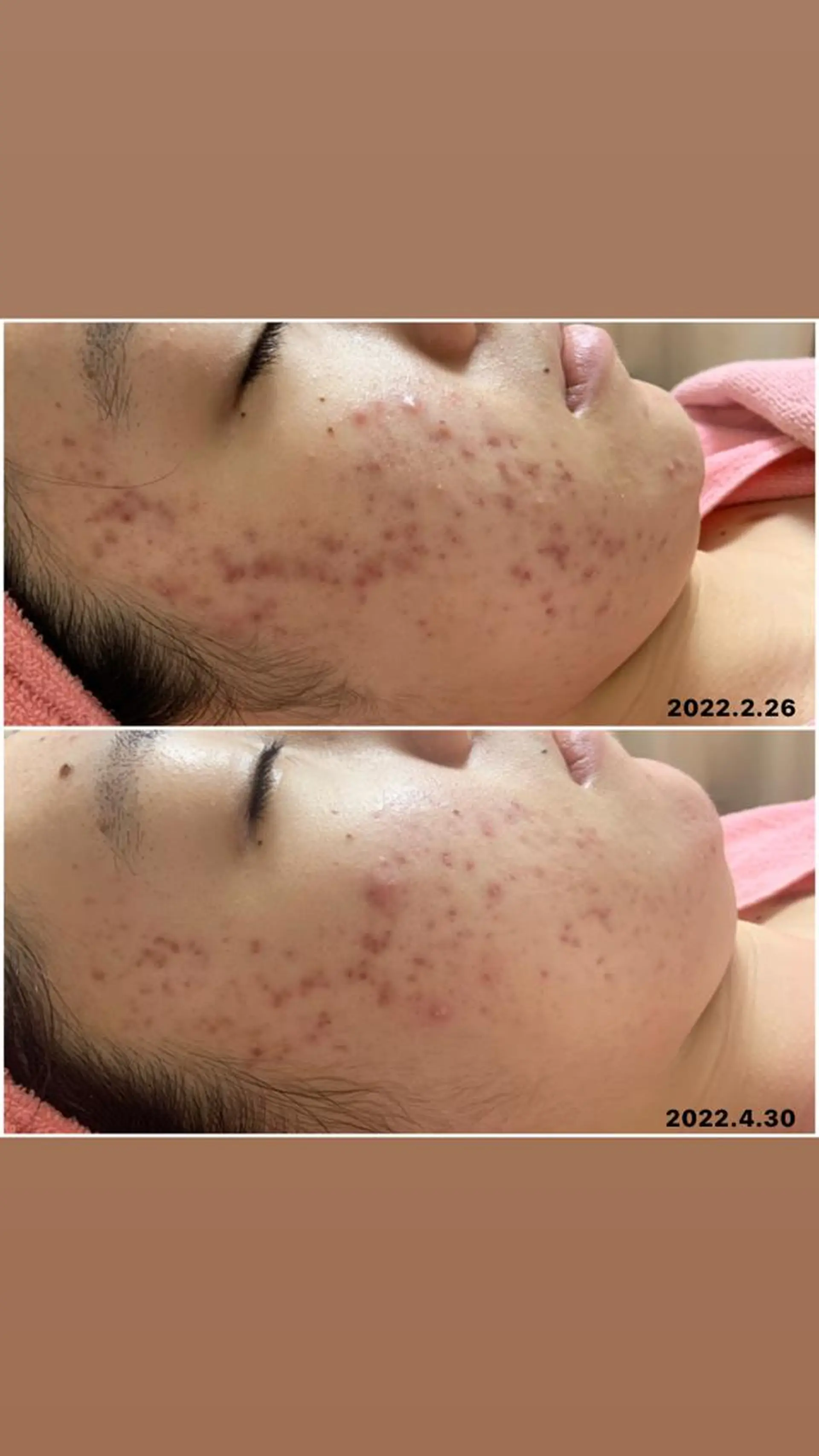 Linomalie エステ/たるみ/脱毛のエステ・リラクイメージ