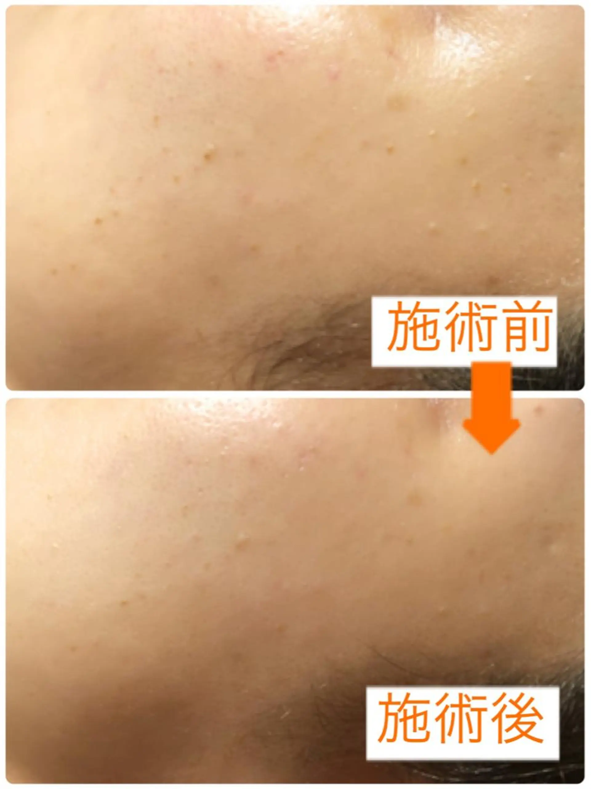 エステ 小顔・毛穴・たるみ ネイル　似内真樹のエステ・リラクイメージ