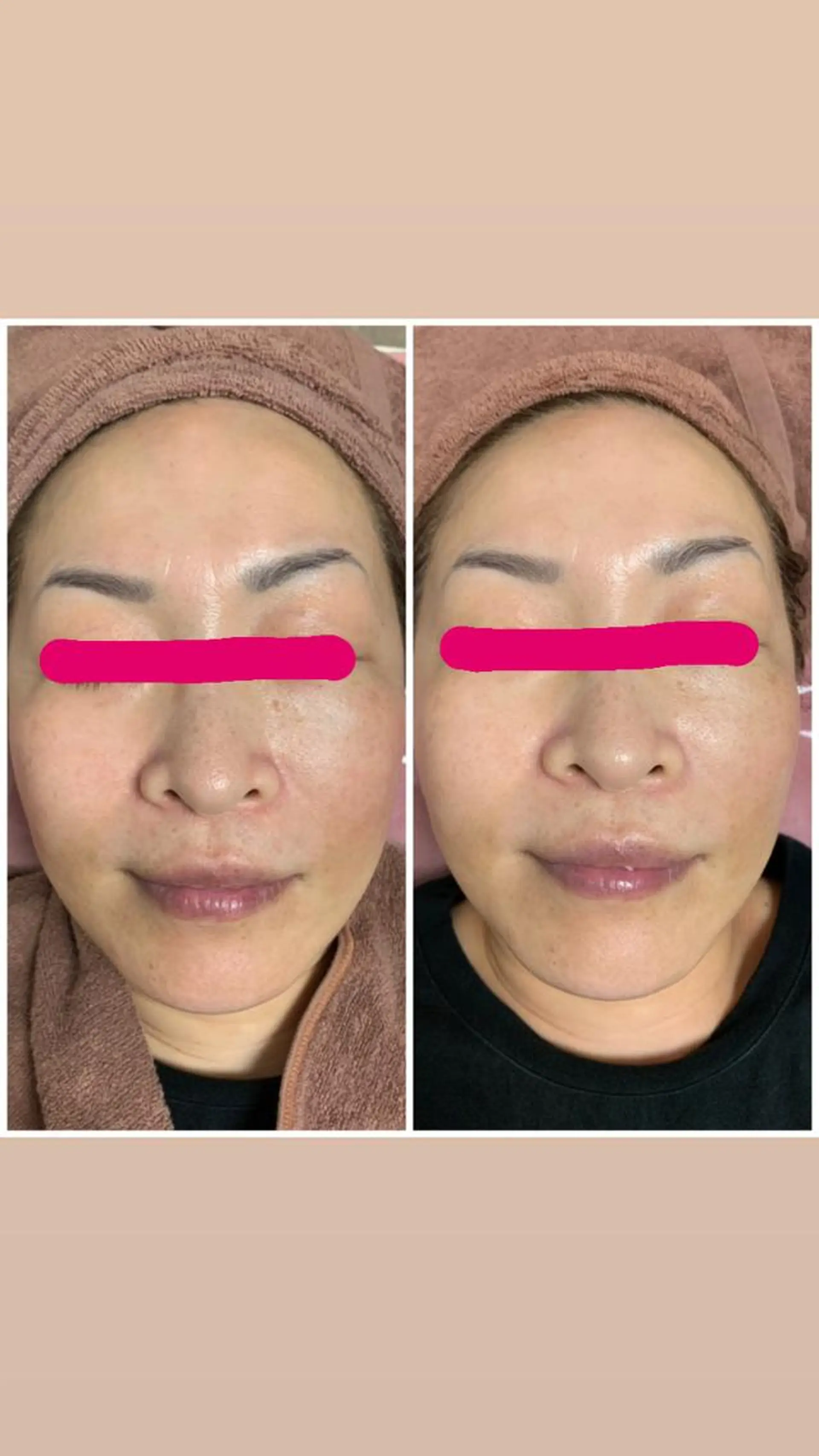 エステ リラク Linomalie エステ/たるみ/脱毛のエステ・リラクイメージ