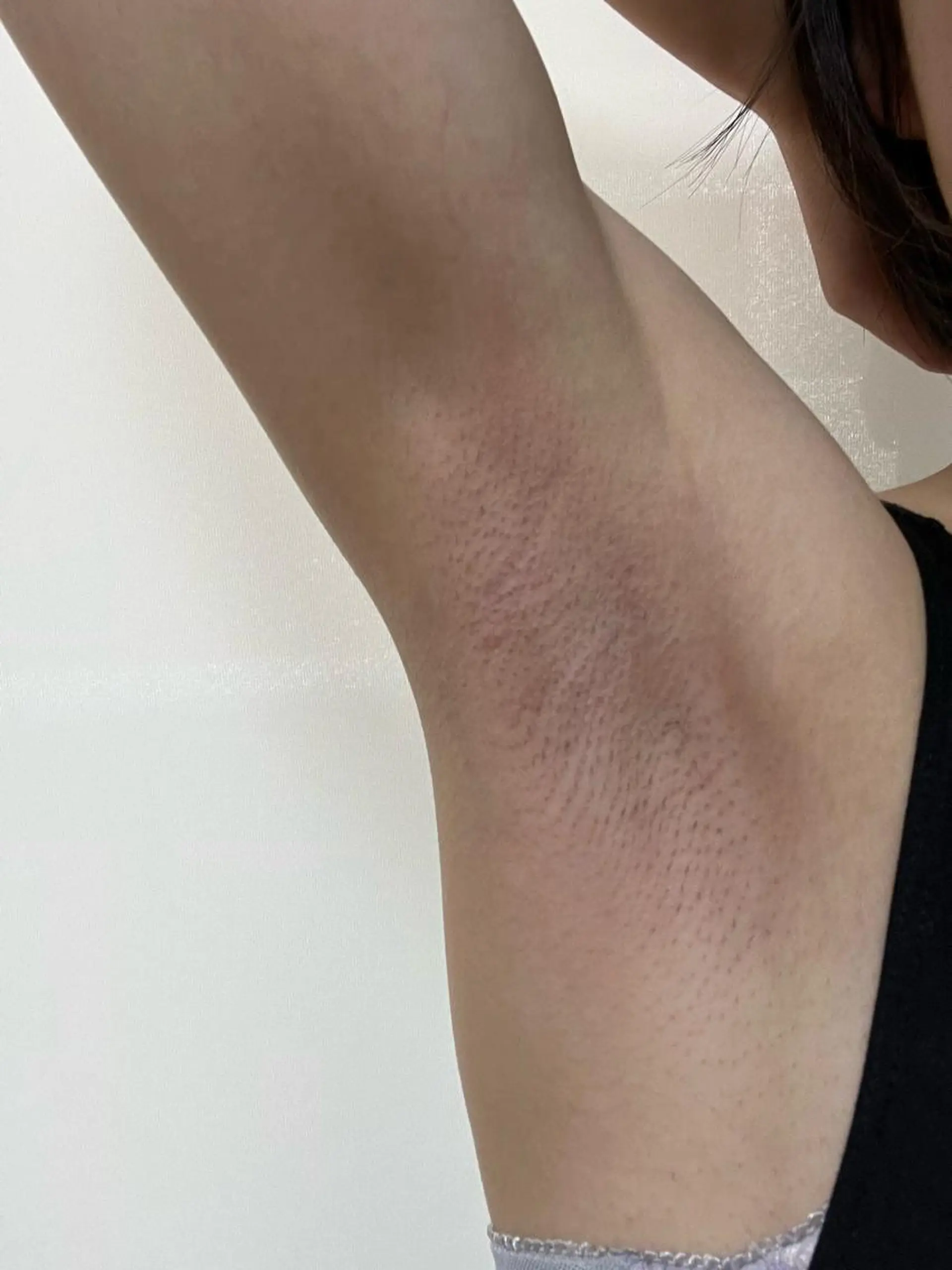 メンズ キッズ 学生（メンズ向け） 脱毛 脱毛SALON RaYNiCKのエステ・リラクイメージ