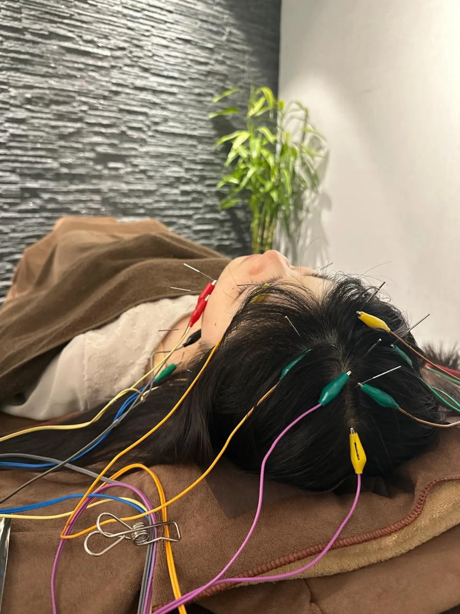 その他 美容鍼灸整体サロンBeauJu所属・小顔矯/美容鍼/鍼灸 BeauJuのその他イメージ