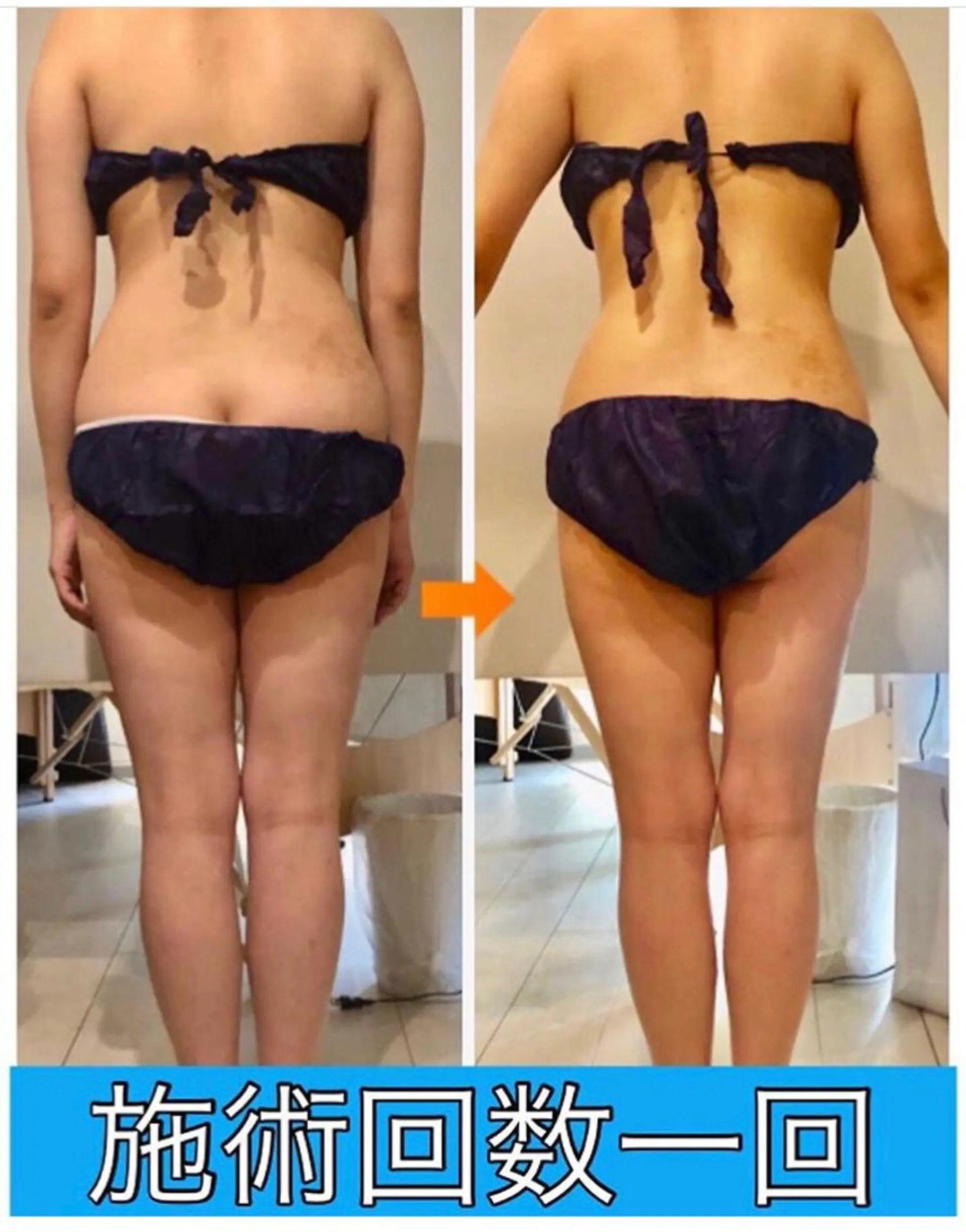 ショート カラー パーマ ヘアアレンジ メンズ キッズ ネイル マツエク・マツパ ‍痩身＆ボディ 結果出し🌟丹野のエステ・リラクイメージ