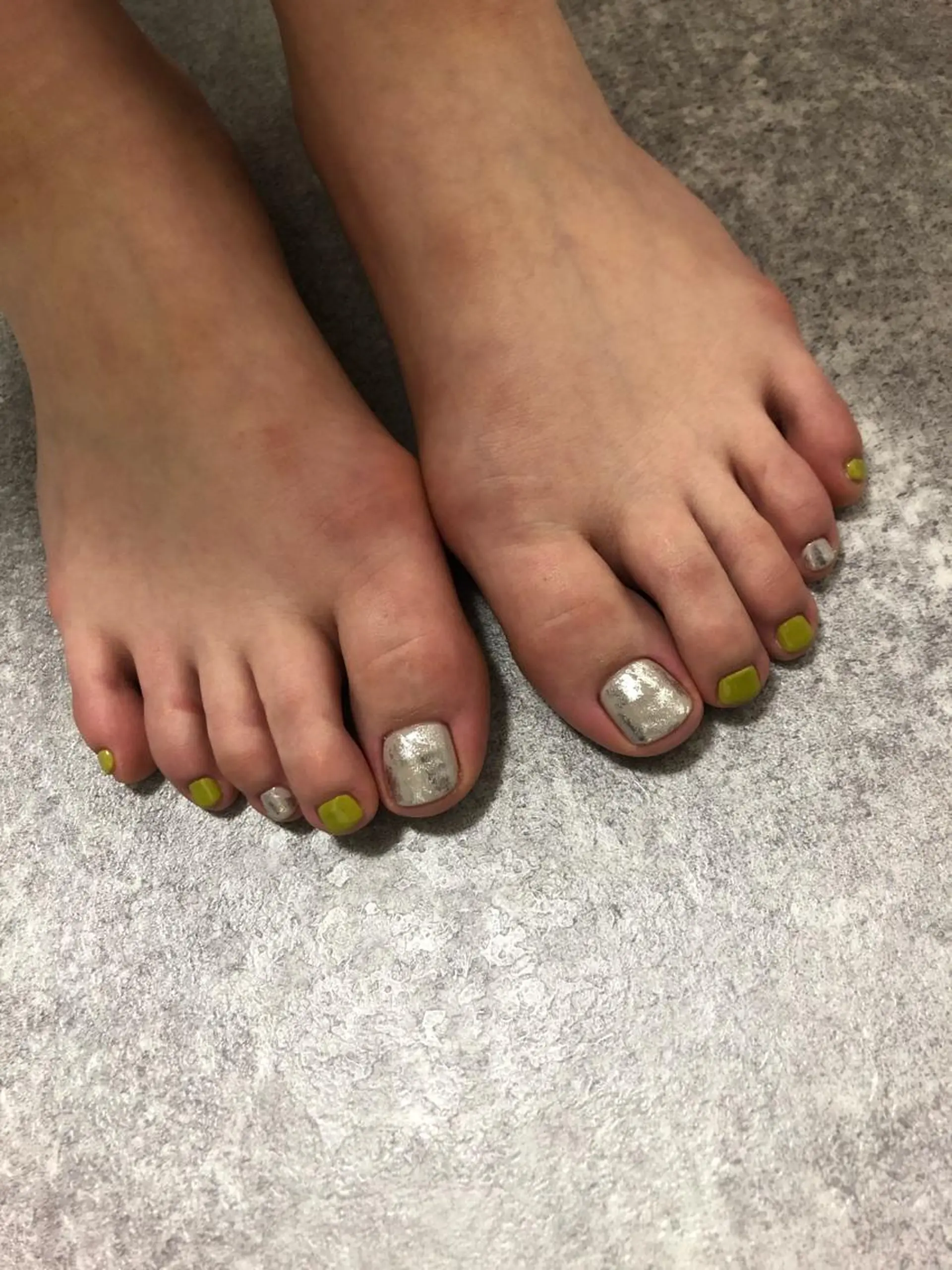 ネイル 【LINON】 airiのネイルデザイン