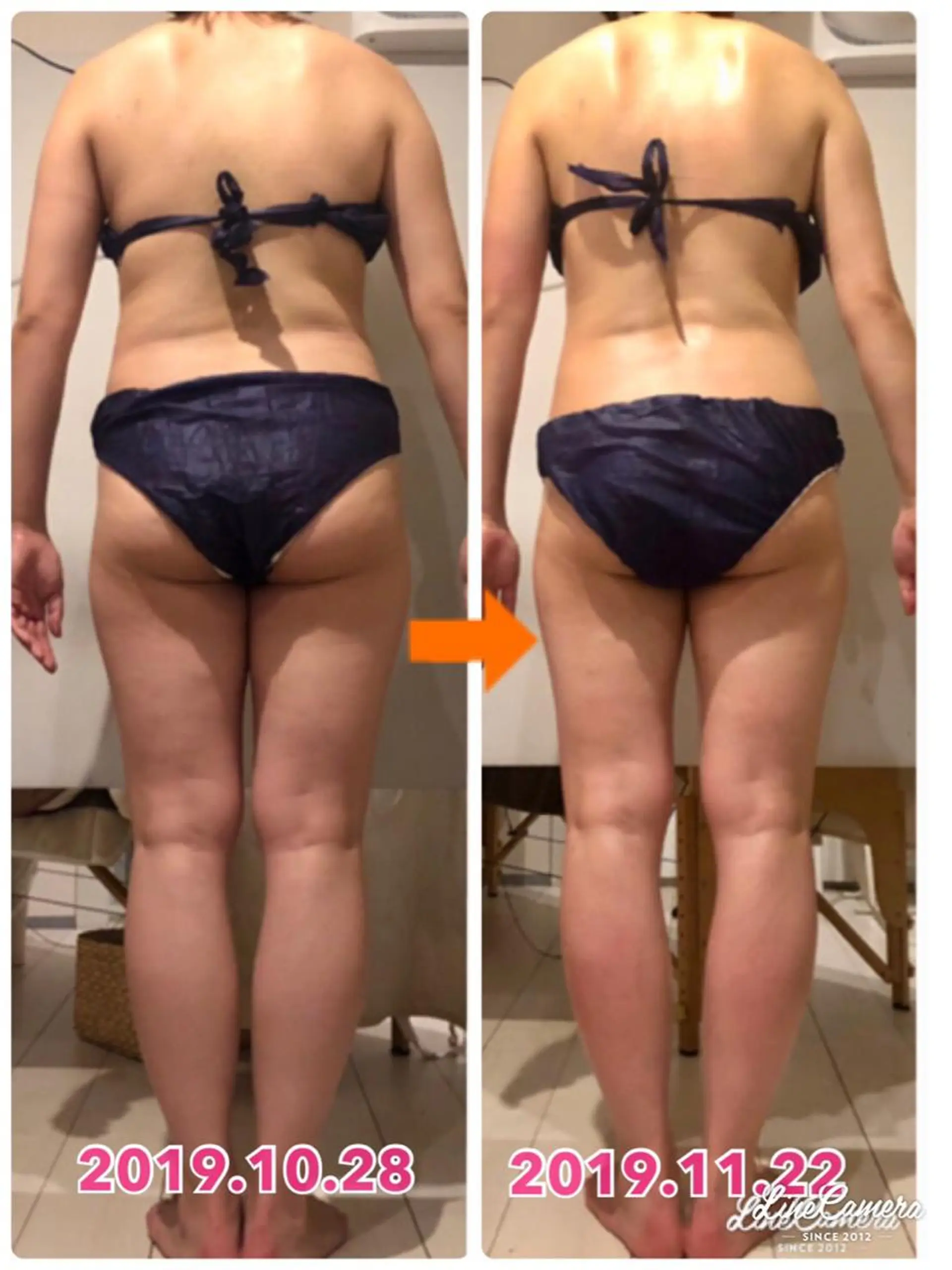 ショート カラー ヘアアレンジ メンズ キッズ ネイル マツエク・マツパ エステ リラク ‍痩身＆ボディ 結果出し🌟丹野のエステ・リラクイメージ