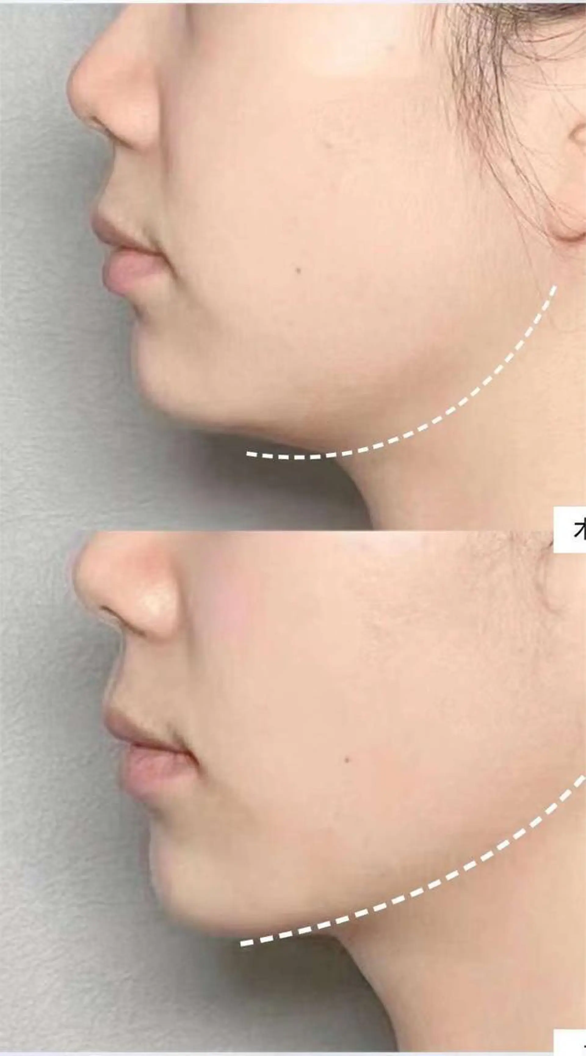 エステ aliaハーブ水光店 エステティシャン募集のエステ・リラクイメージ