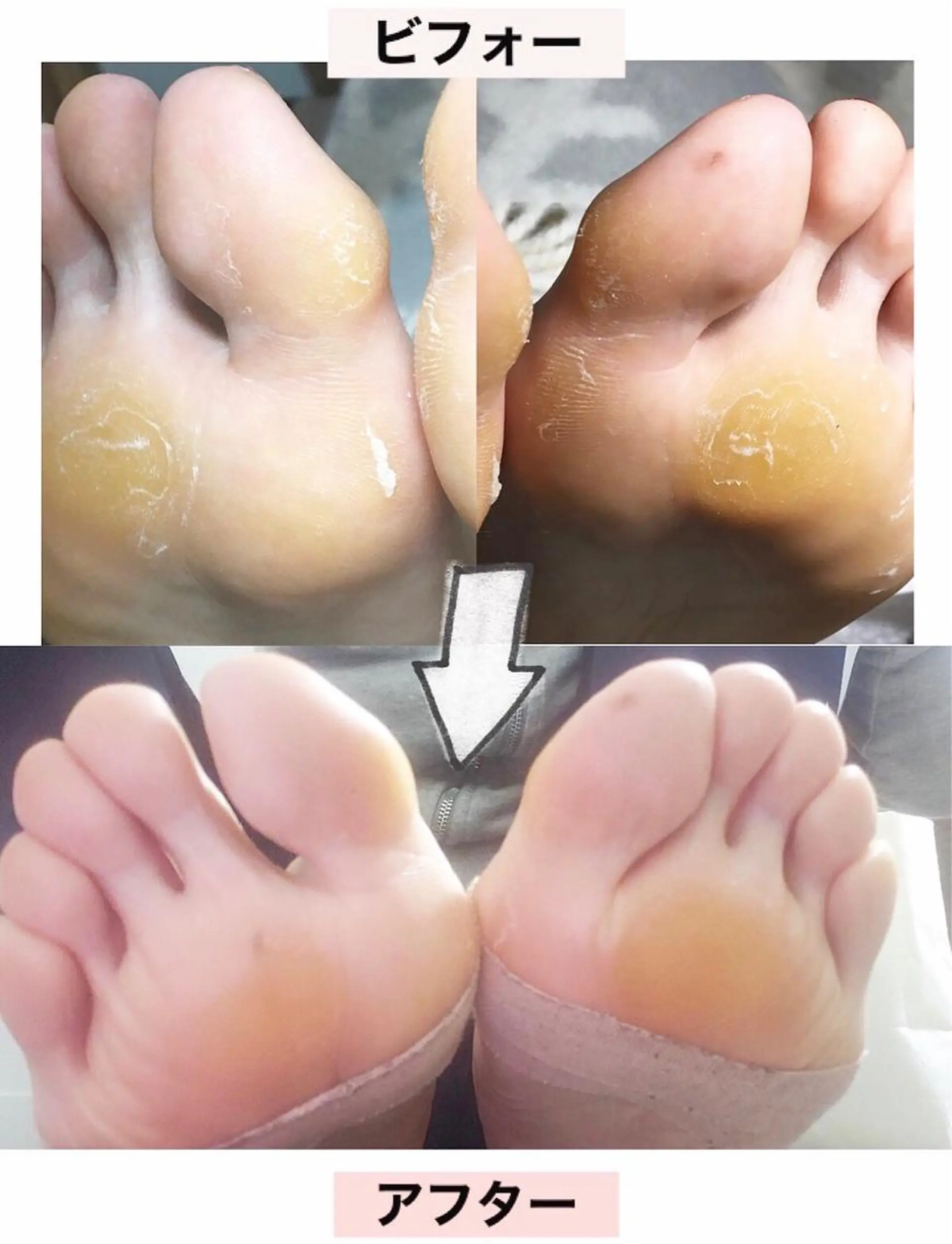 ネイル フットネイル atelier nife.のネイルデザイン