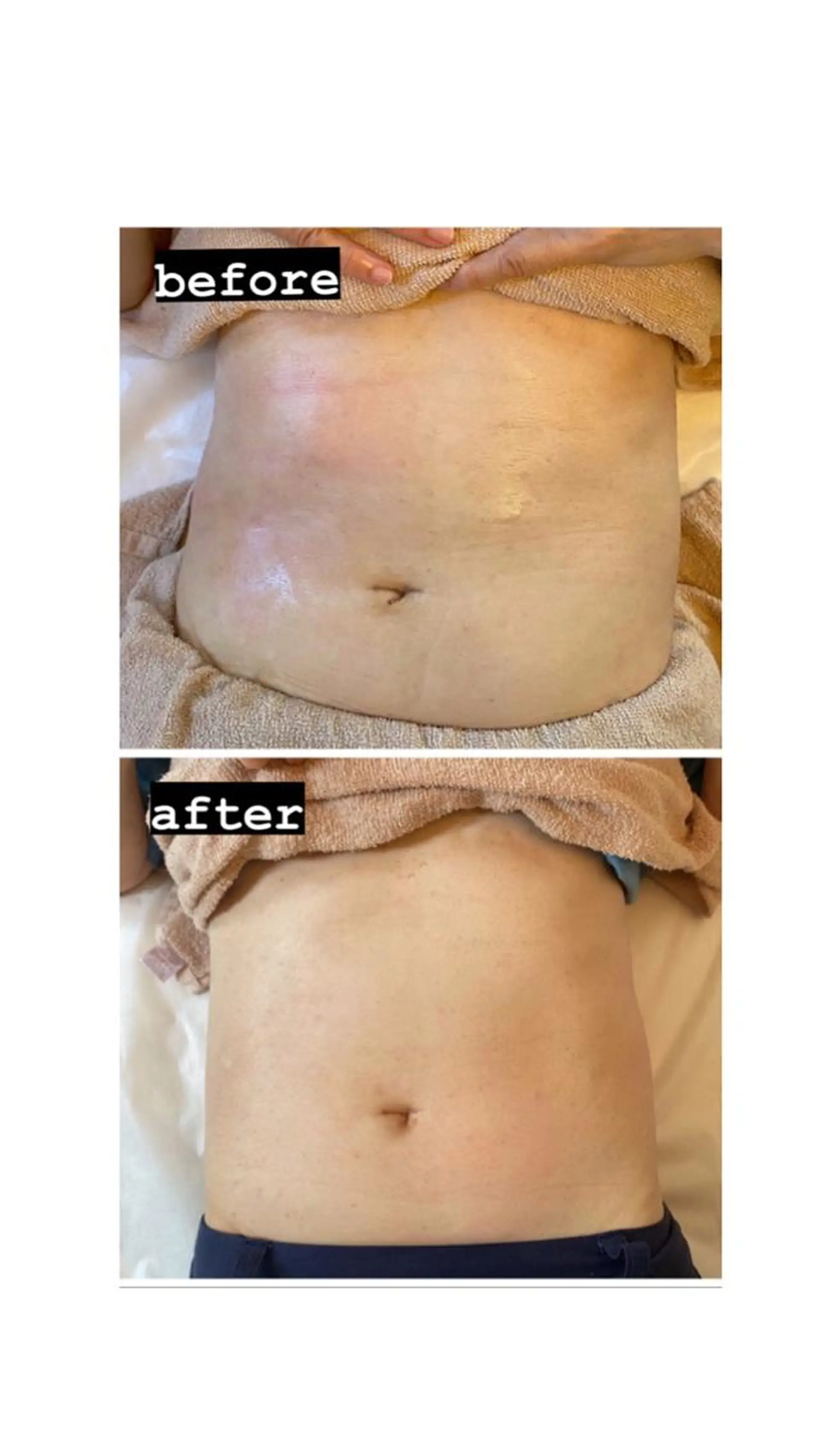 脱毛・エステサロン LuLuNのエステ・リラクイメージ