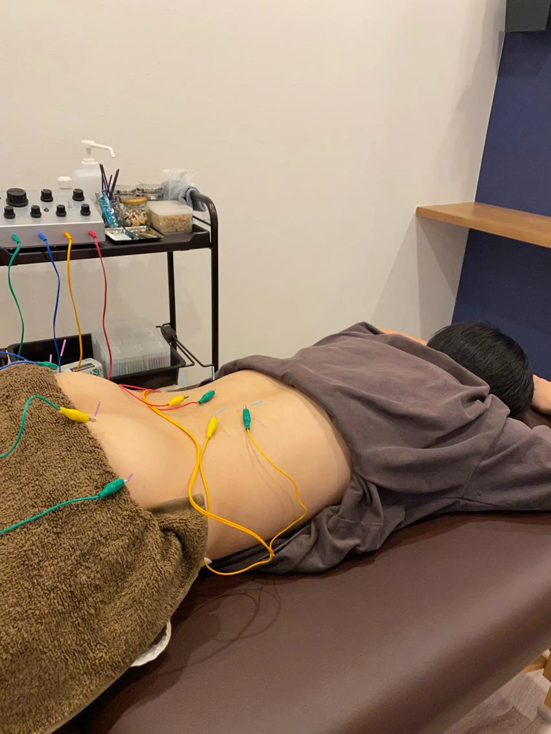 エステ リラク 肌質改善×美容鍼 ゆいのエステ・リラクイメージ