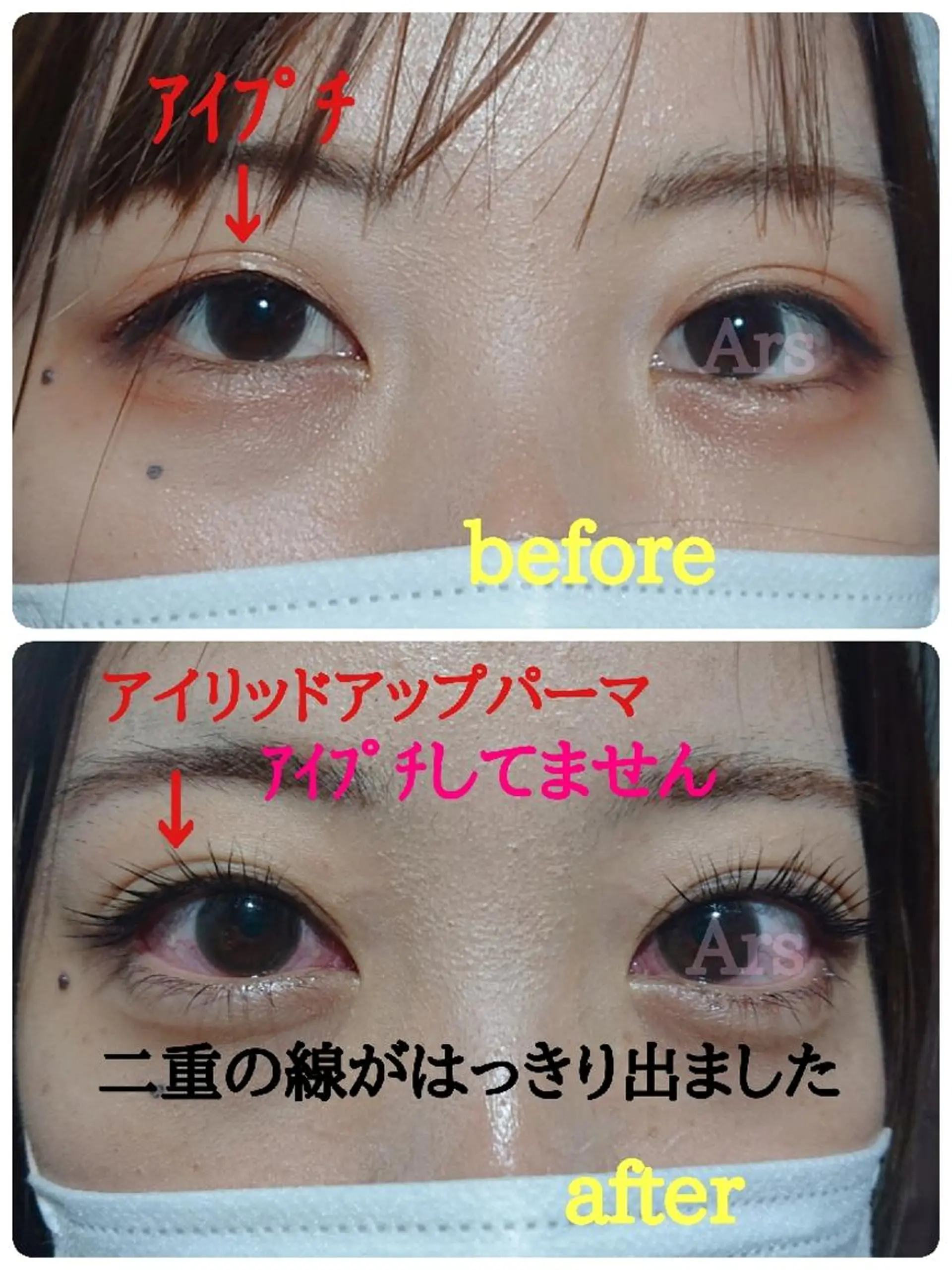 マツエク・マツパ メンズ メンズパーマ アイリッドアップパーマ Ars      (ｱﾙｽ)のマツエク・マツパデザイン