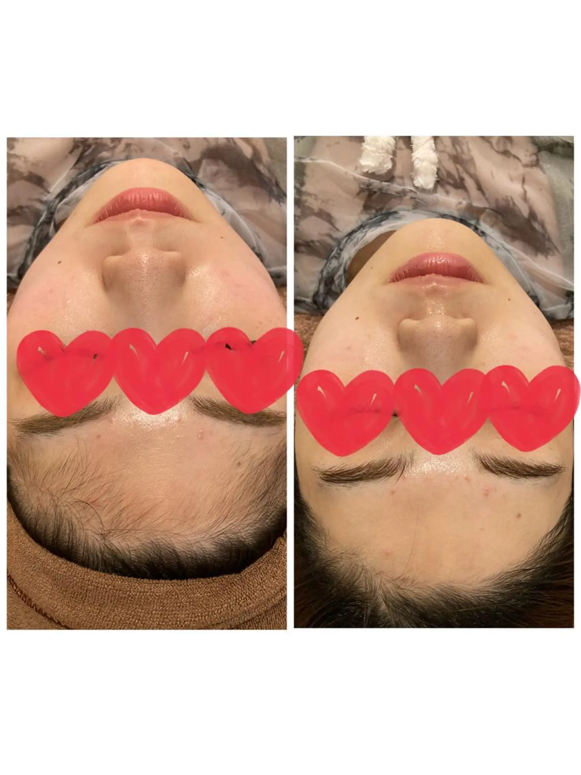 脱毛 ULULU 上野店のエステ・リラクイメージ