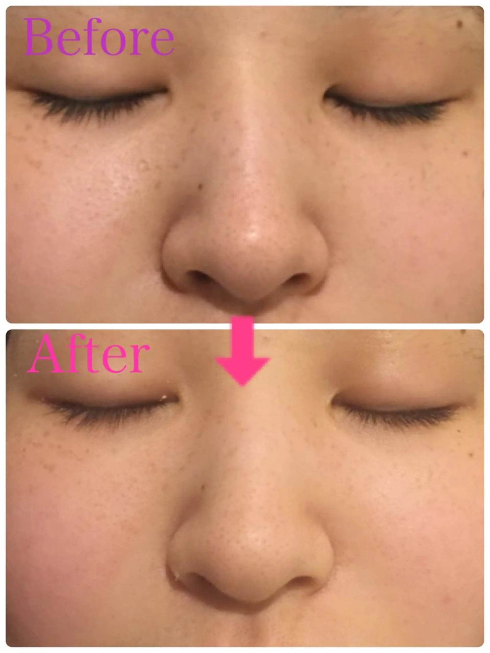 ロング カラー パーマ ヘアアレンジ メンズ キッズ ネイル マツエク・マツパ ‍痩身＆ボディ 結果出し🌟丹野のエステ・リラクイメージ