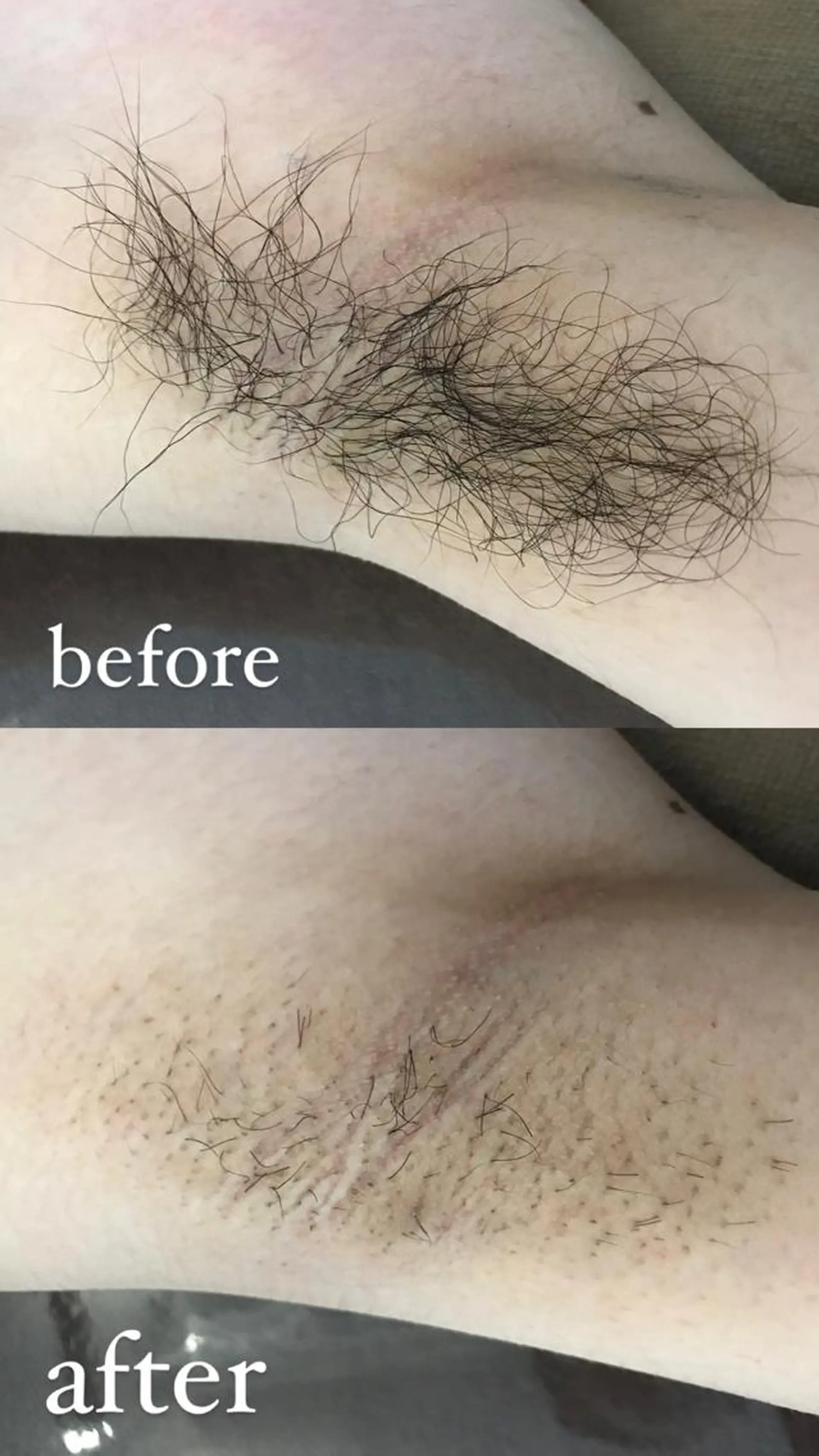 脱毛 Lilyboo 池袋のエステ・リラクイメージ