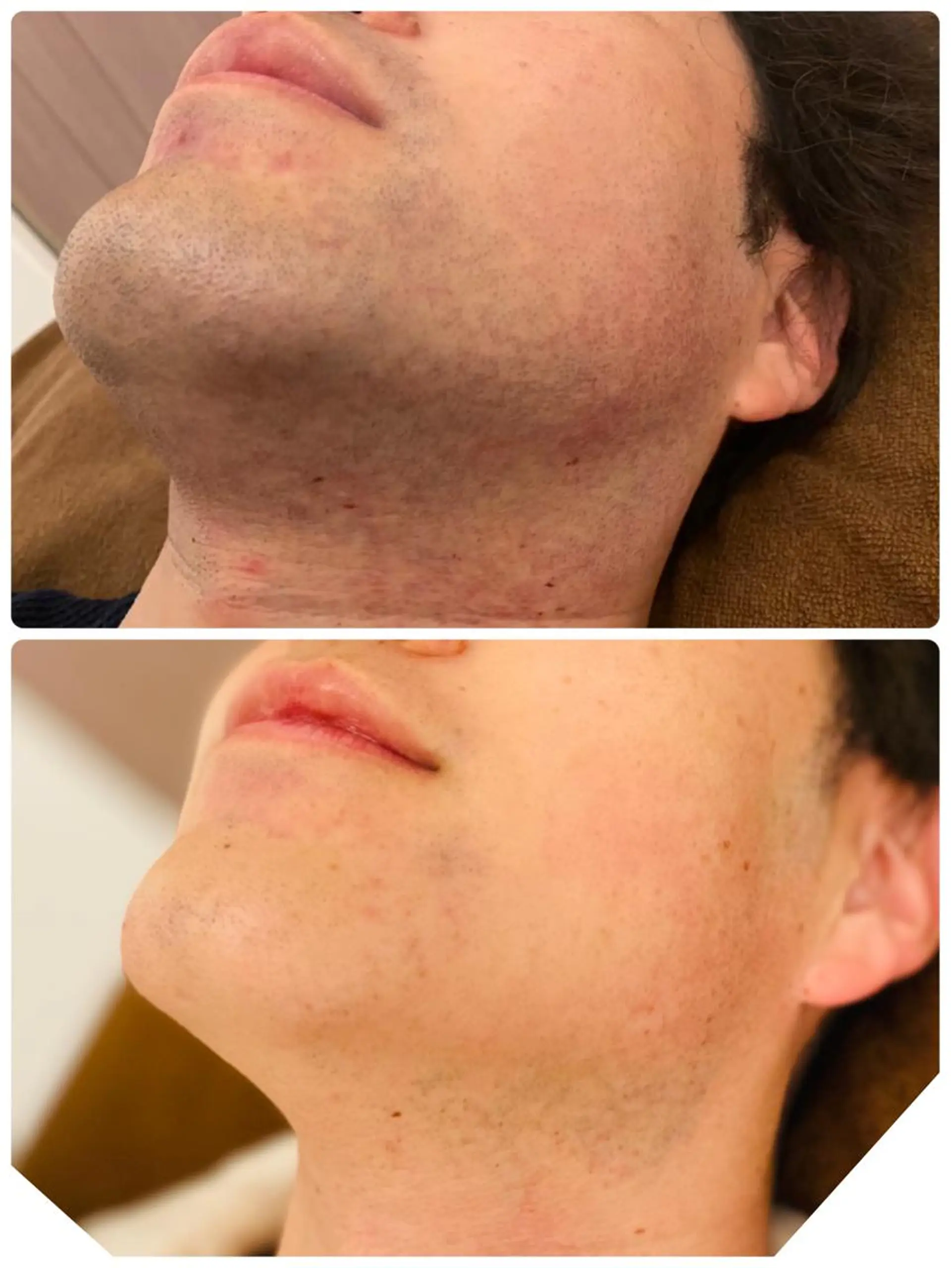 メンズ 岡部 陵子のエステ・リラクイメージ