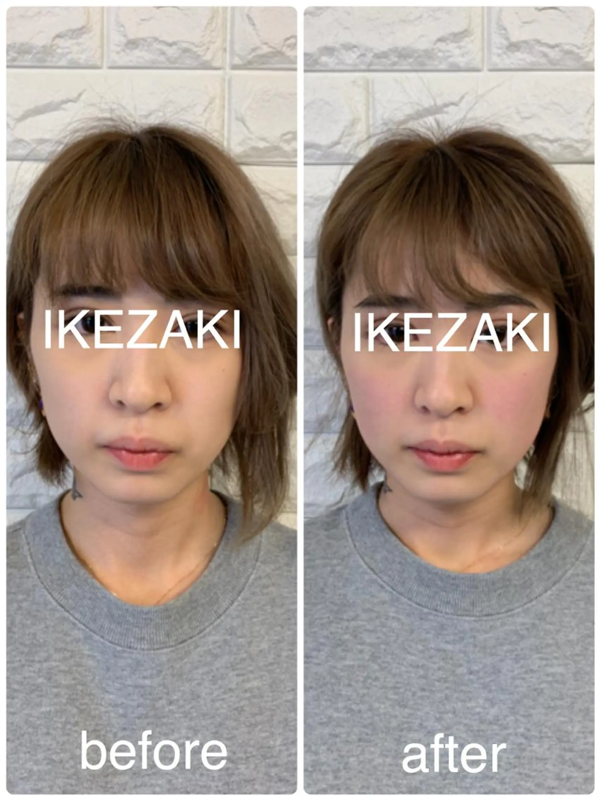 美容鍼 IKEZAKIのエステ・リラクイメージ
